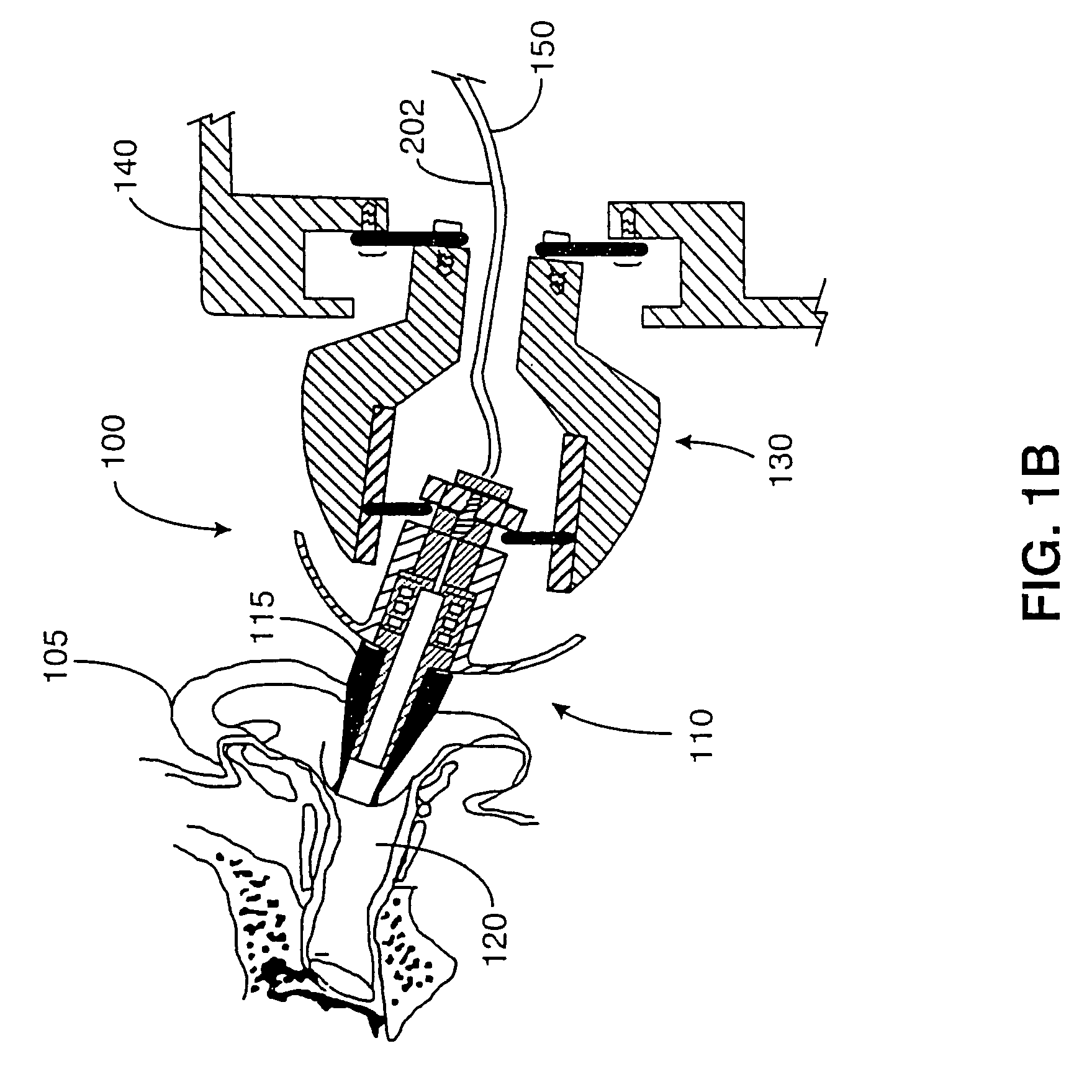 Hand-held hearing screener apparatus