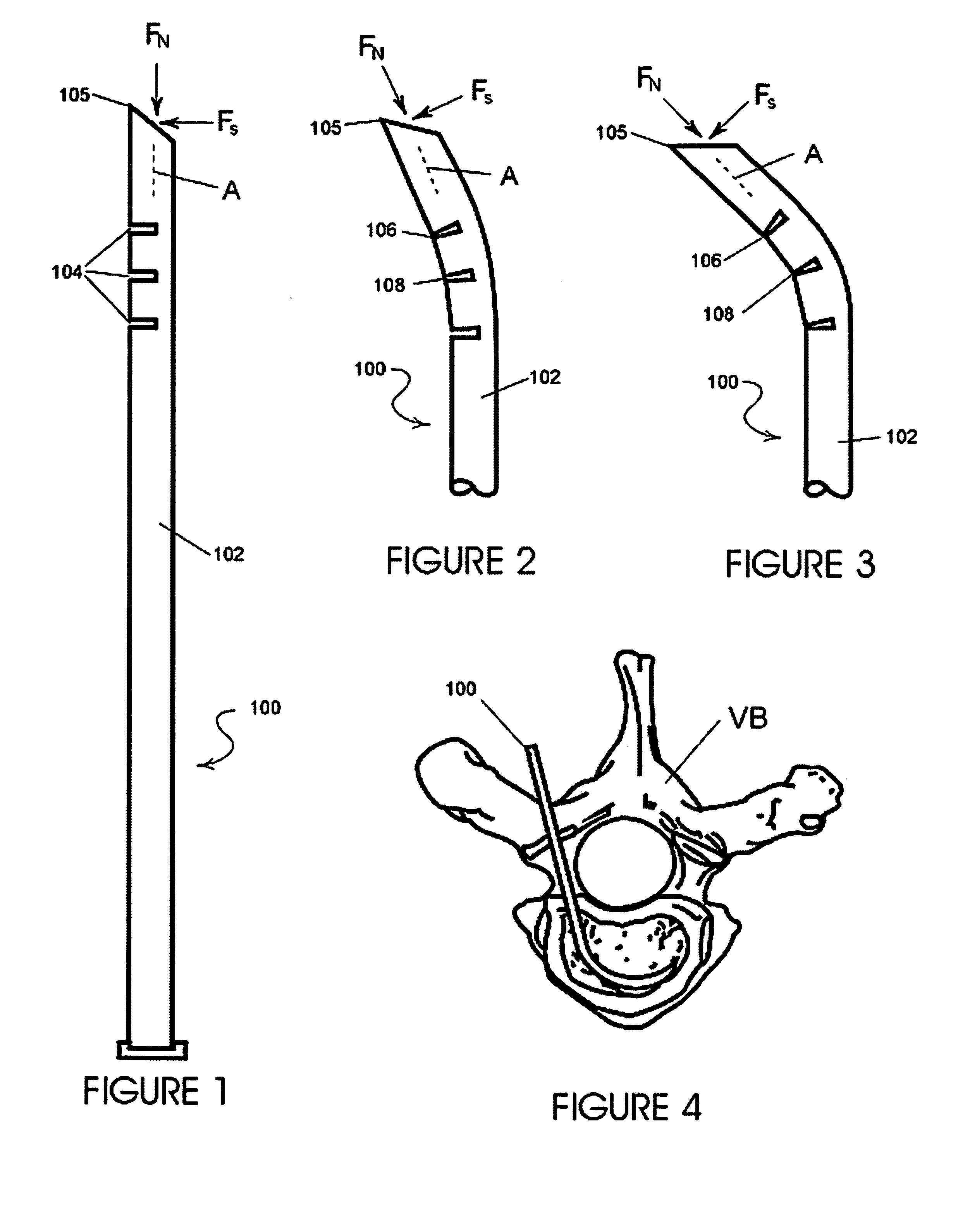 Orthopedic surgery access devices