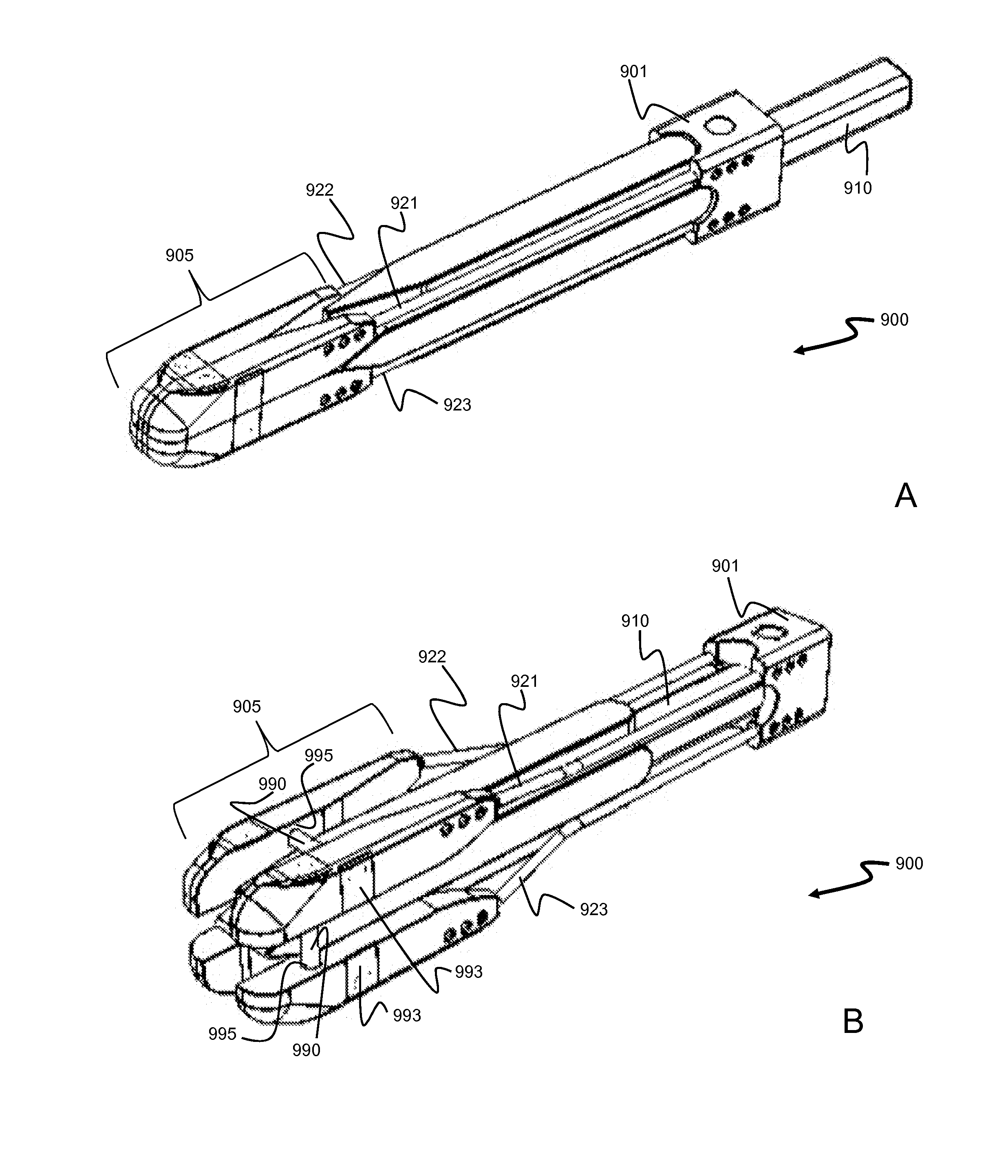 Staged, bilaterally expandable trial