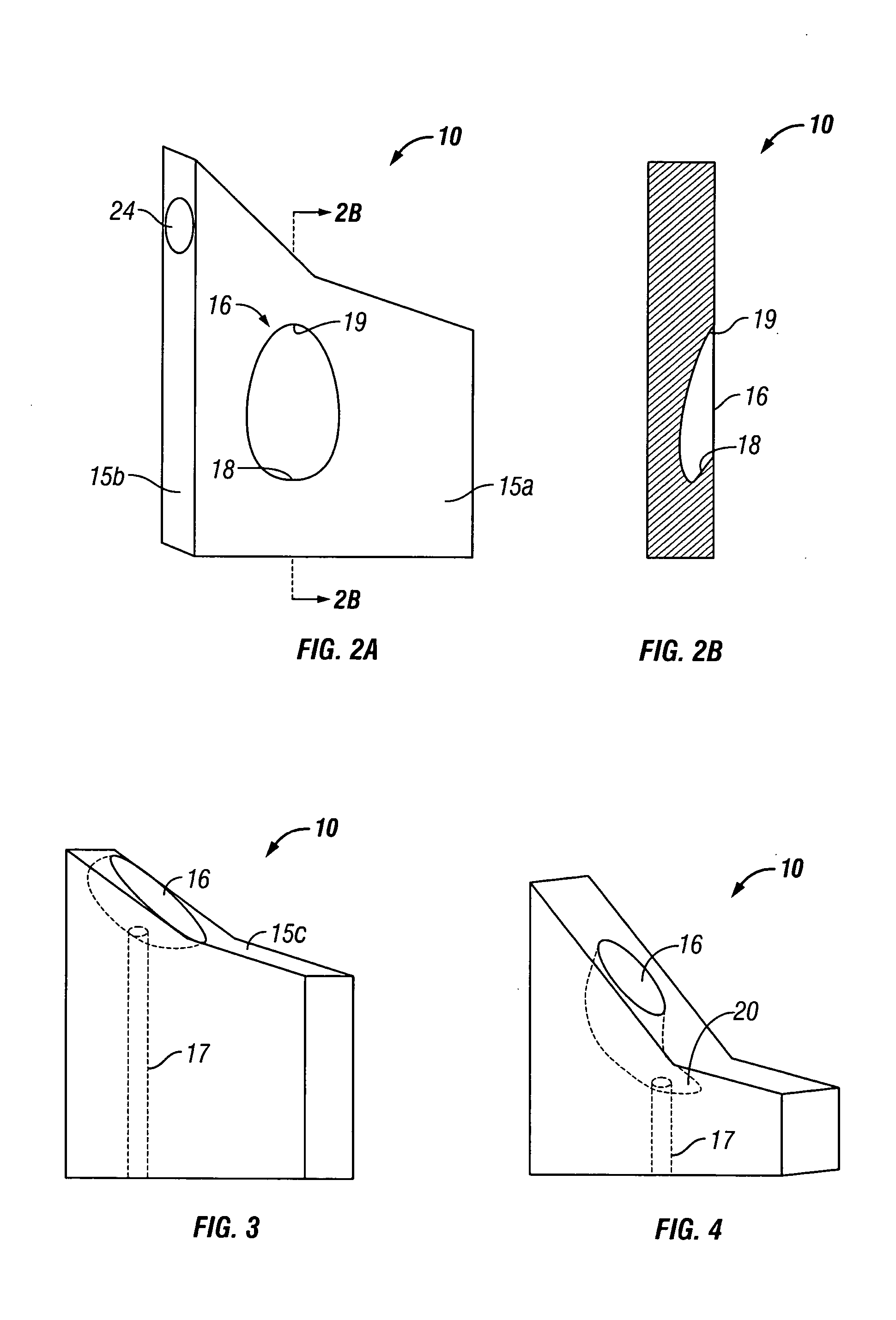 Device and method for intradermal cell implantation