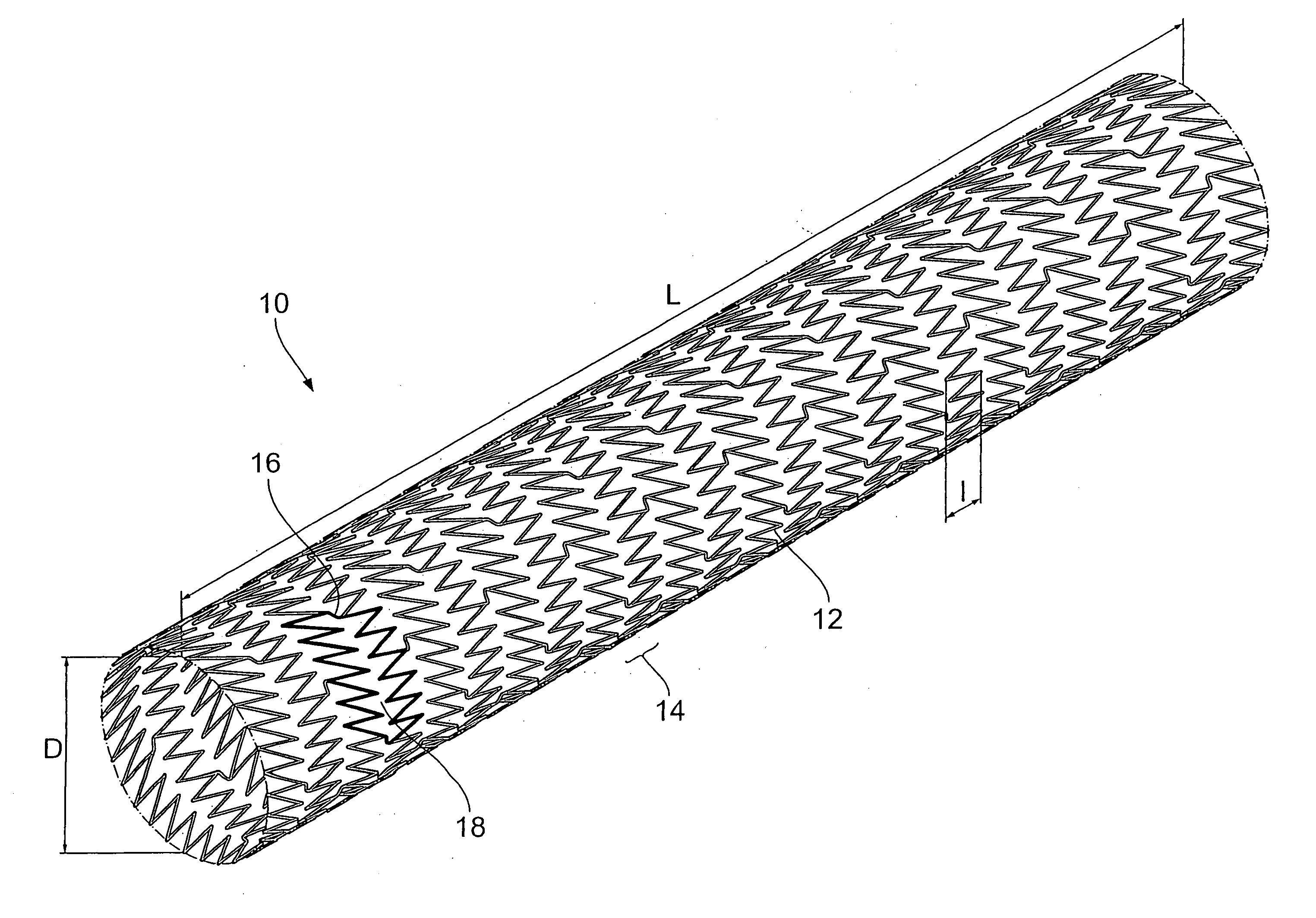 Endoprosthesis comprising a magnesium alloy