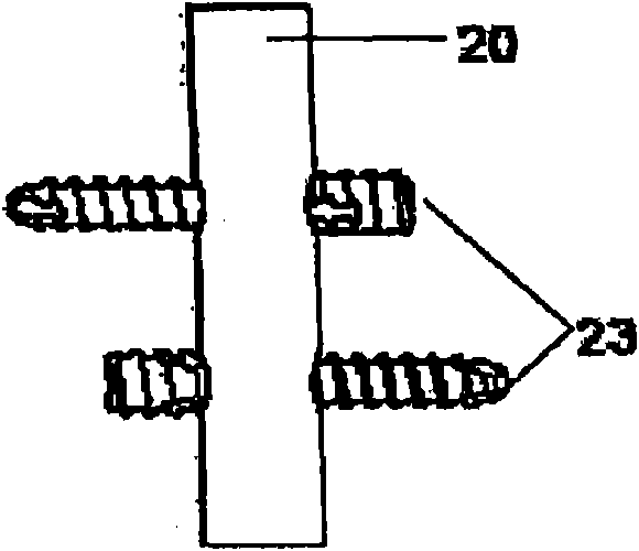 Nail system and method for an olecranon osteotomy