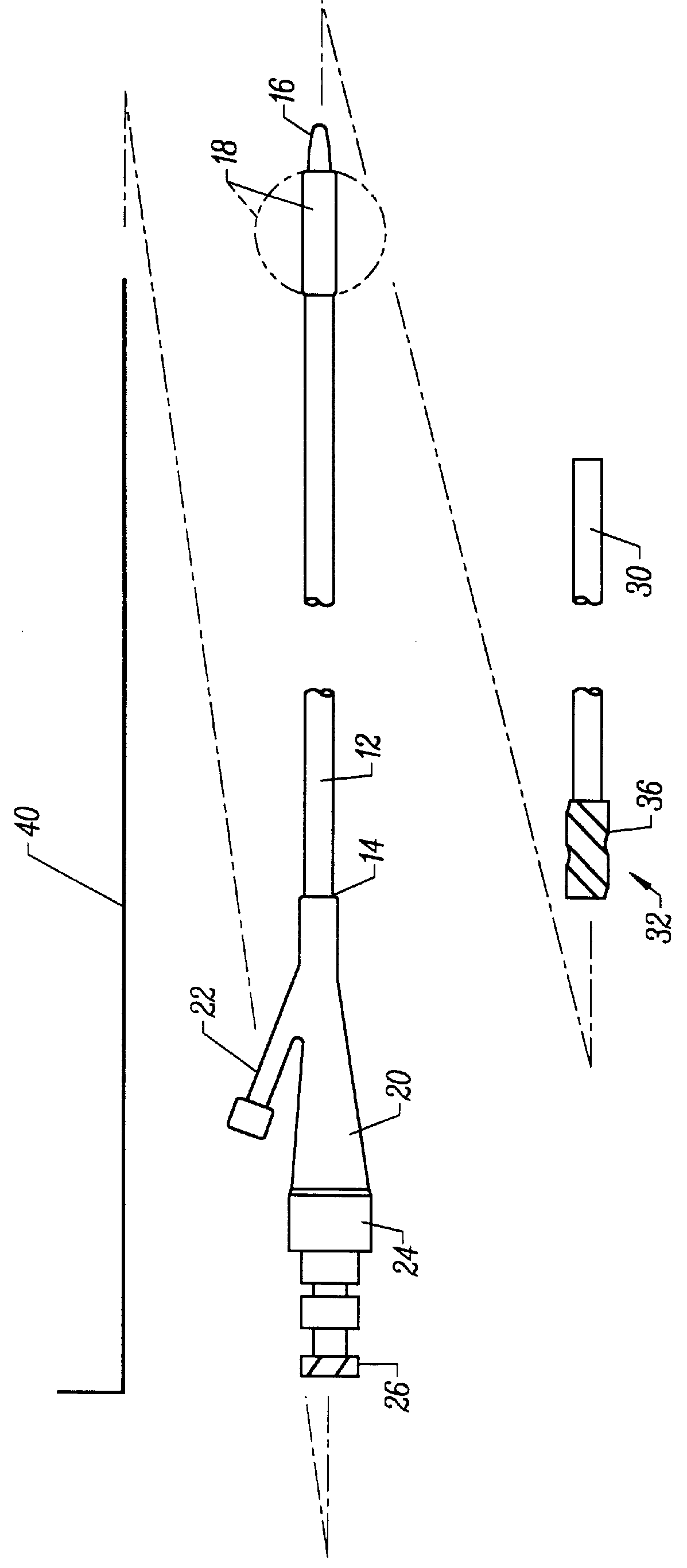 Method and apparatus for performing hysterosalpingography