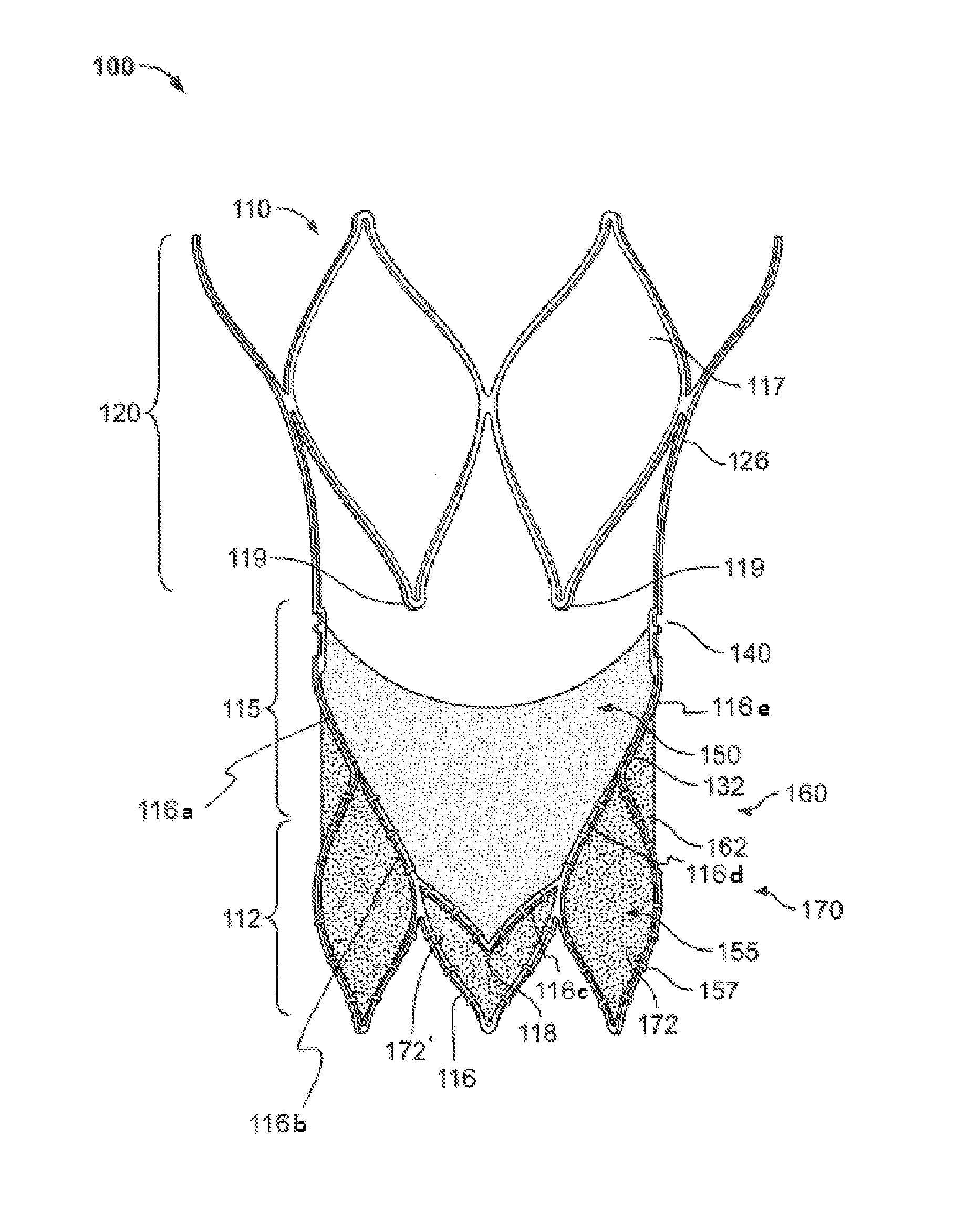 Stent with alternative cell shapes