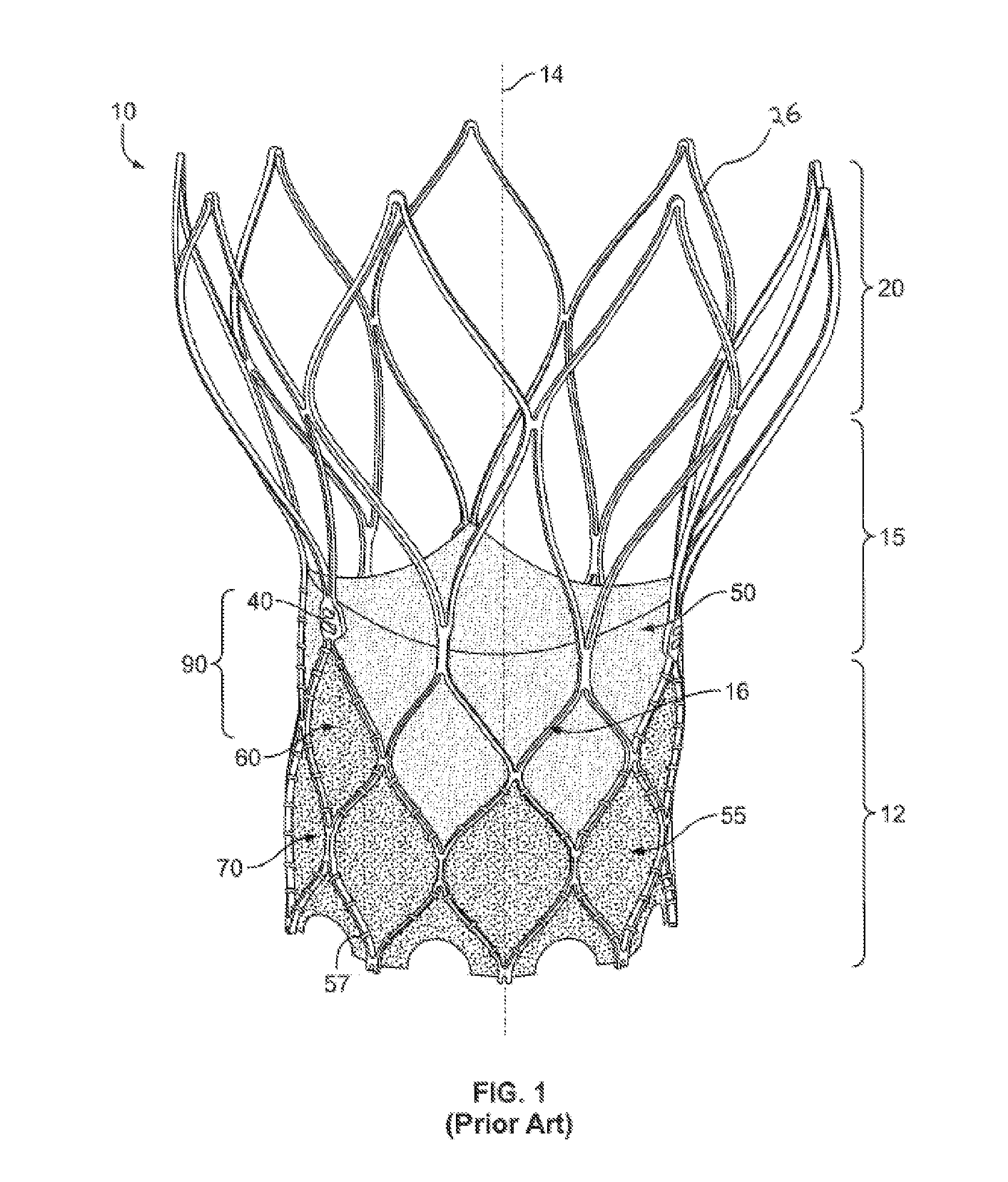 Stent with alternative cell shapes