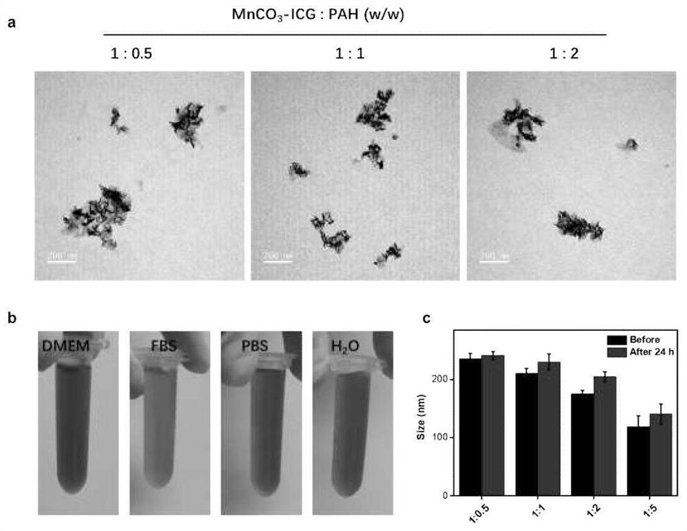 Preparation method and application of medical carbonate nano material