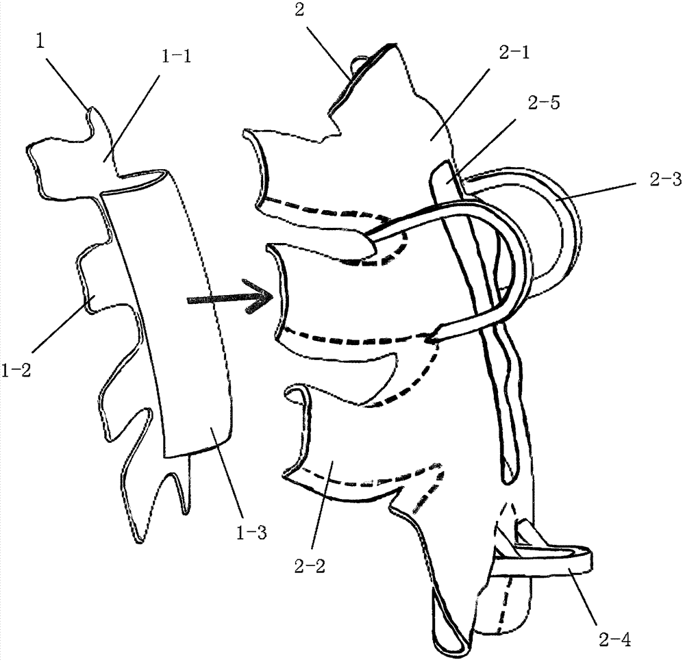 Guide plate for sternum reconstruction and manufacturing method of guide plate