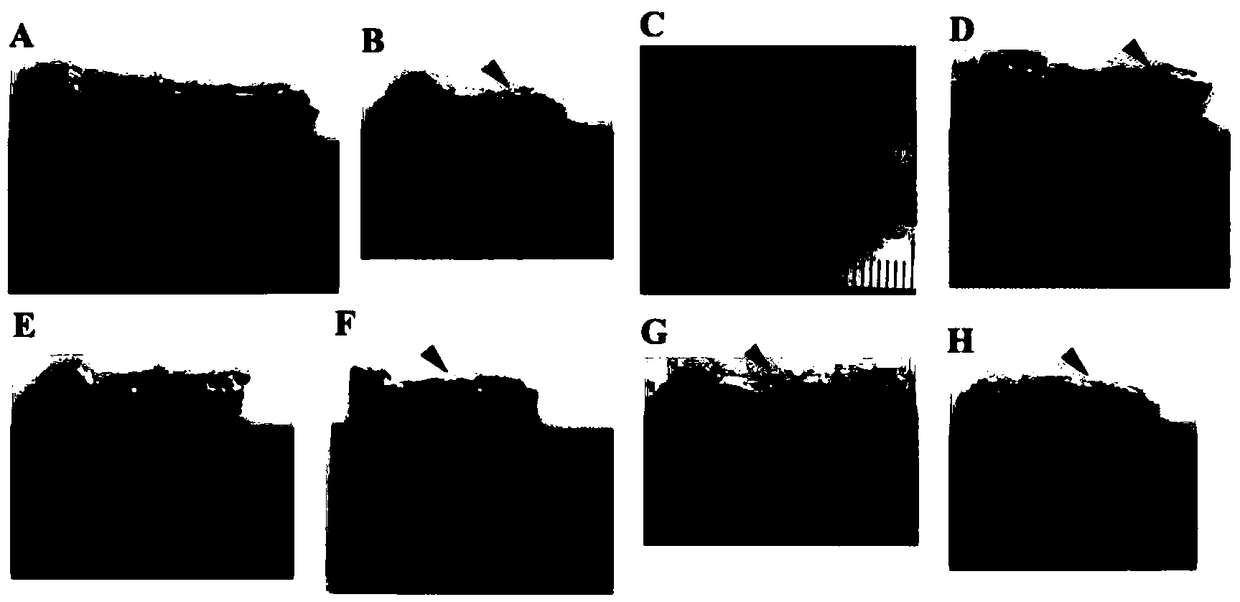 Stem cell composite PLGA (polylactic-co-glycolic acid) support kit and application thereof