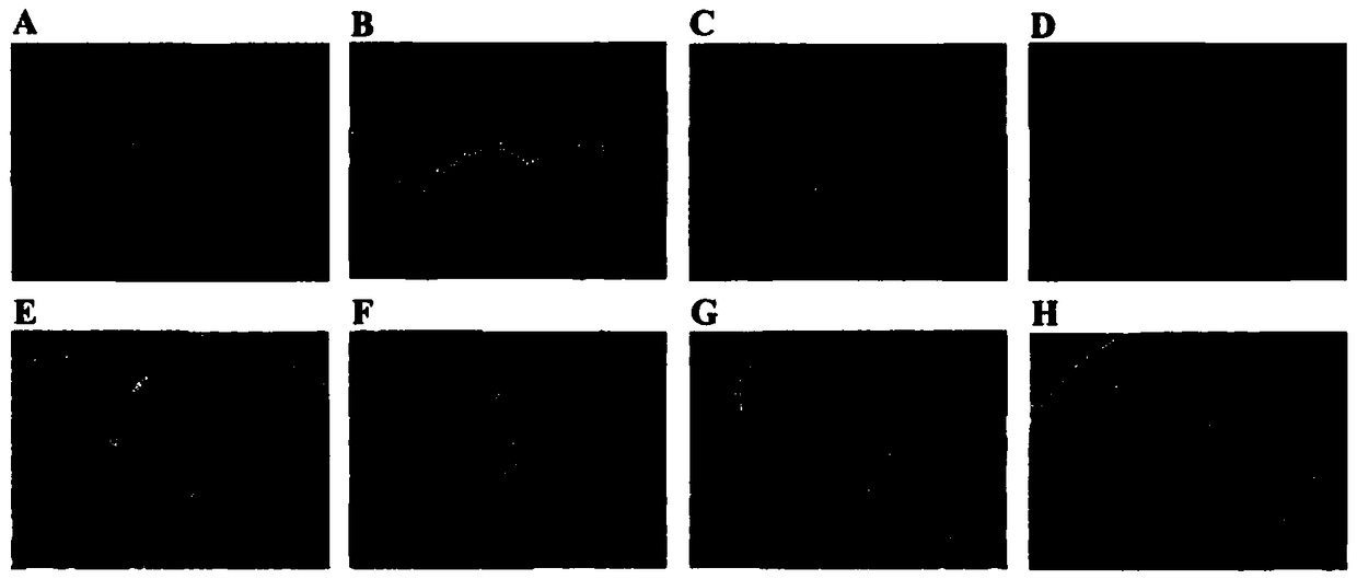 Stem cell composite PLGA (polylactic-co-glycolic acid) support kit and application thereof