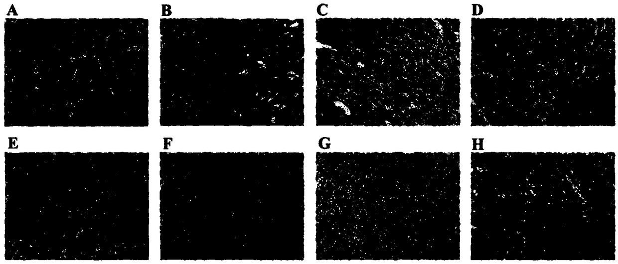 Stem cell composite PLGA (polylactic-co-glycolic acid) support kit and application thereof