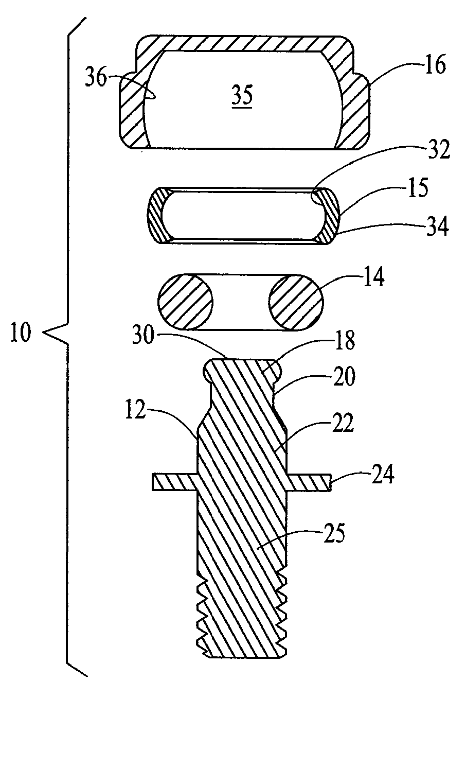 Dental attachment assembly and method