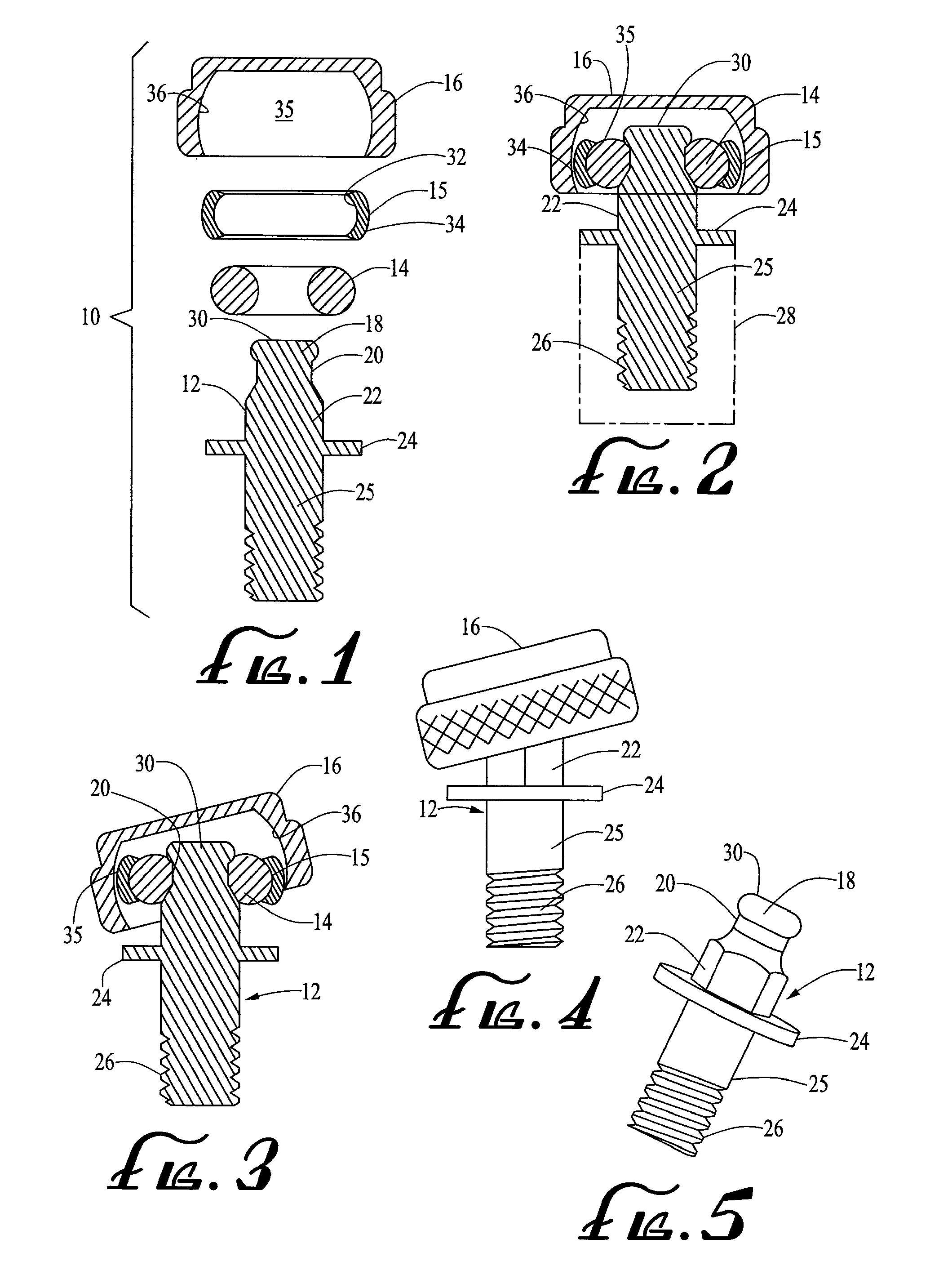 Dental attachment assembly and method