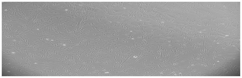 Exosome mouth wash as well as preparation method and application thereof