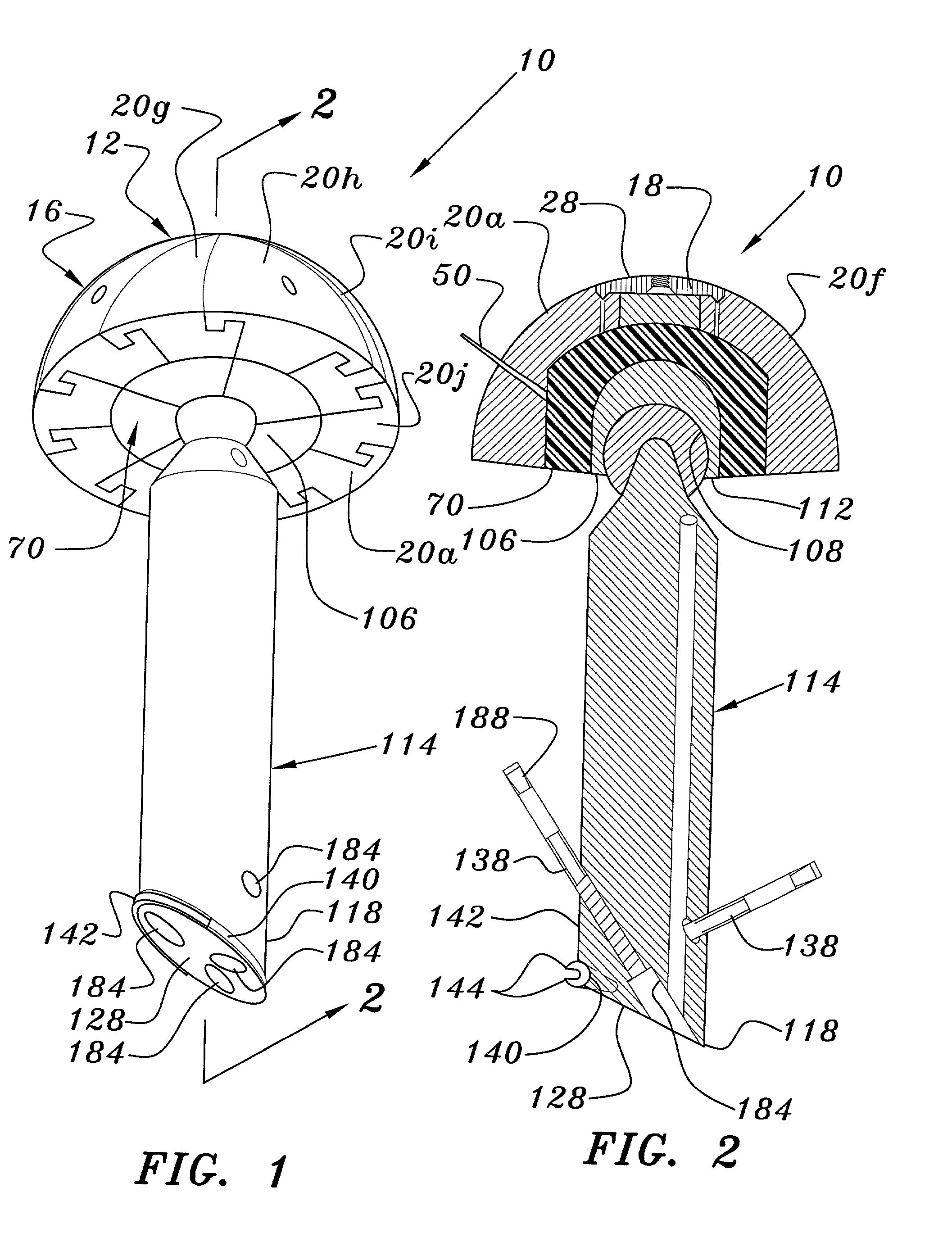 Joint prosthesis and method for placement