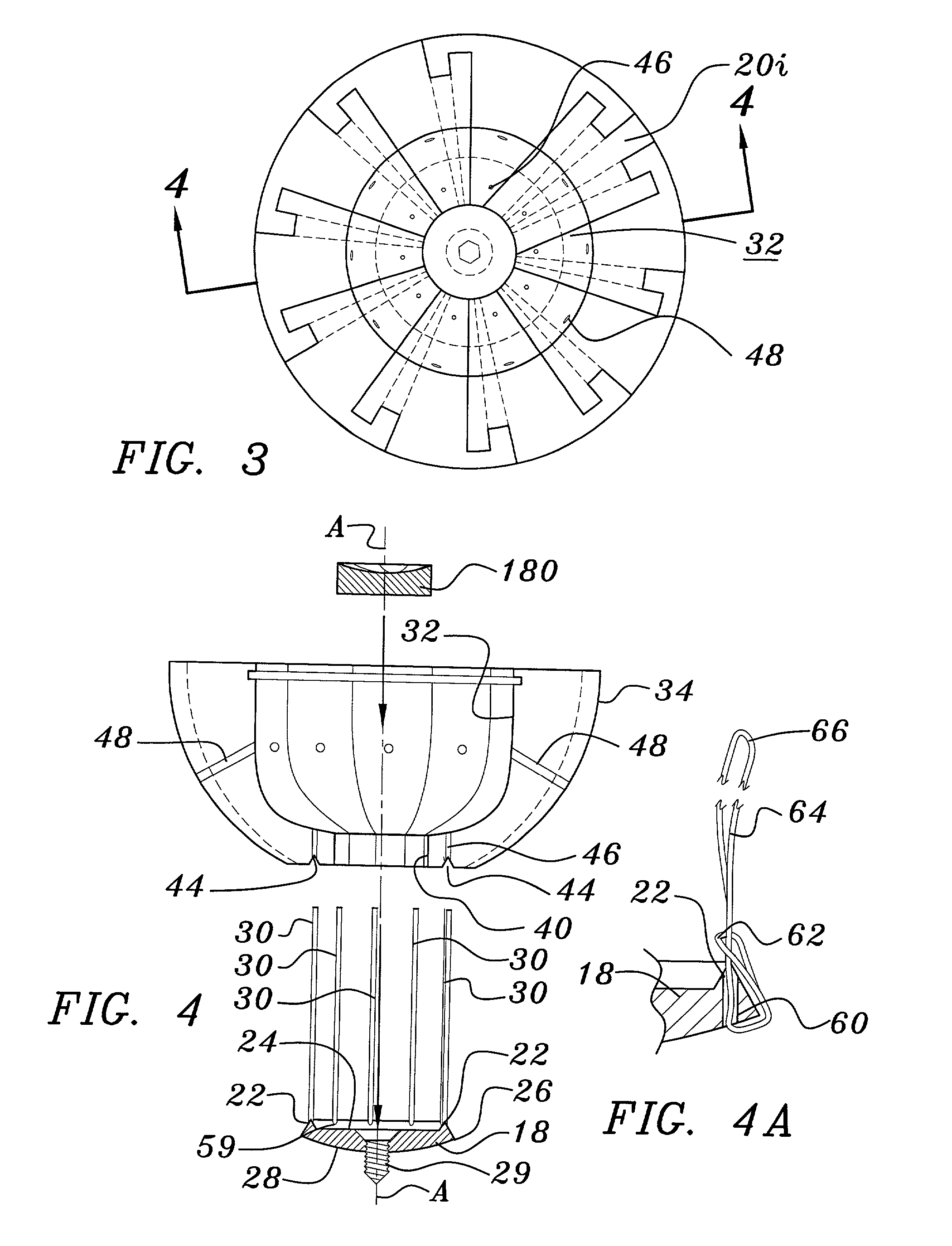 Joint prosthesis and method for placement