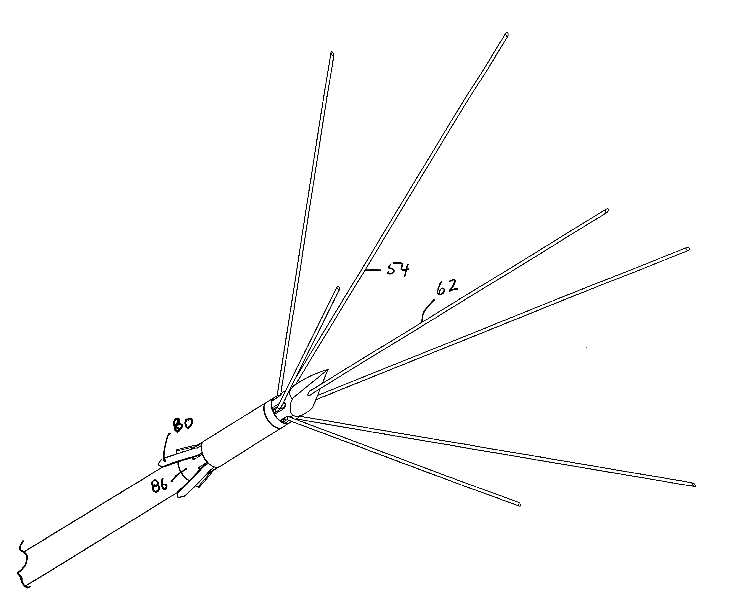 Anchored RF ablation device for the destruction of tissue masses