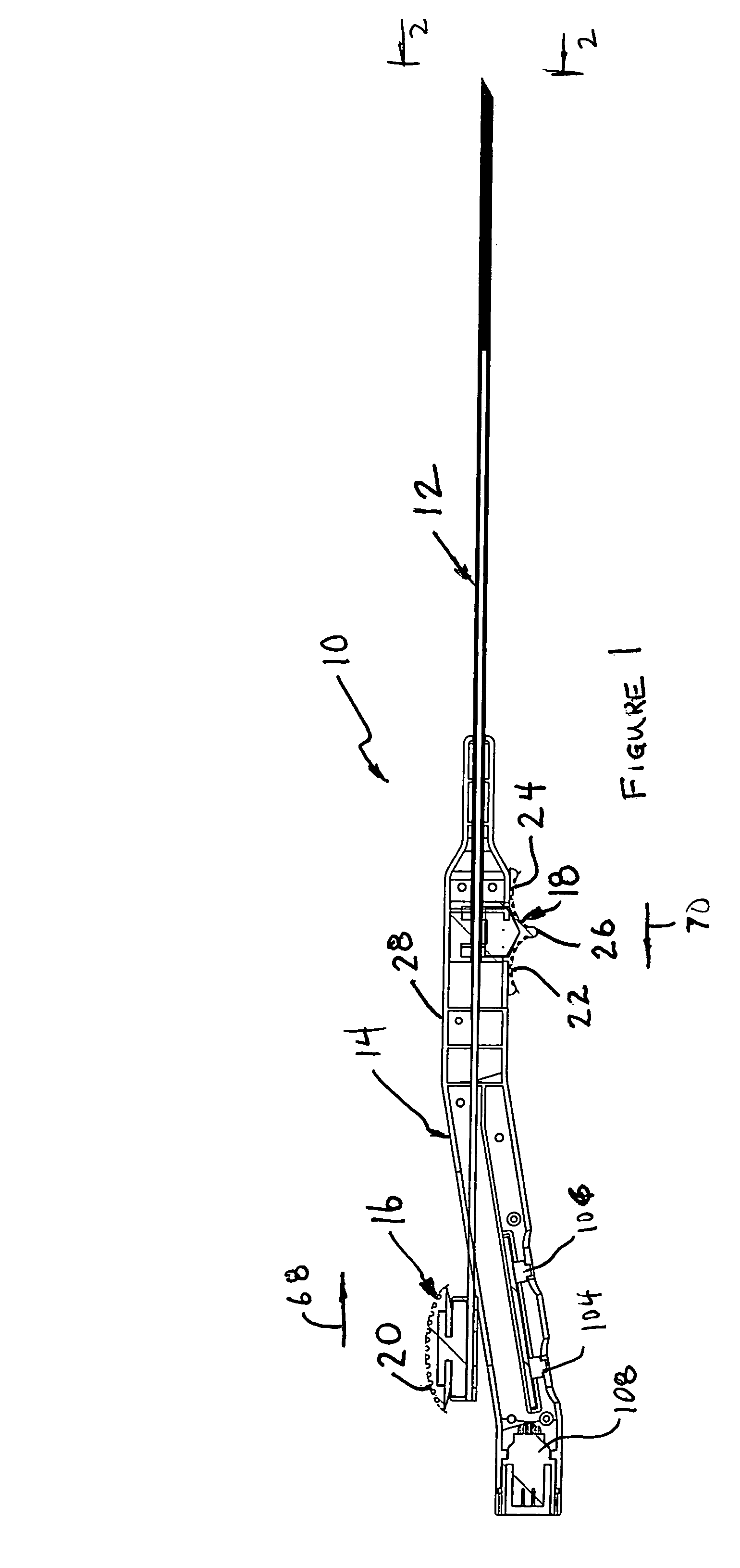 Anchored RF ablation device for the destruction of tissue masses