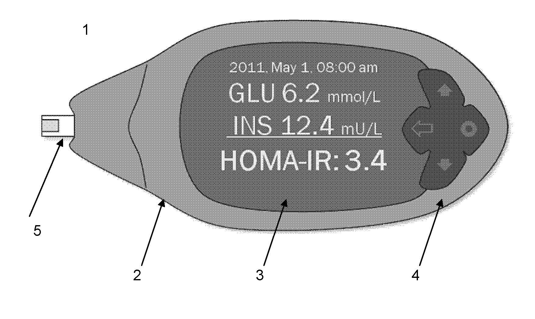 Assay and method for determining insulin-resistance