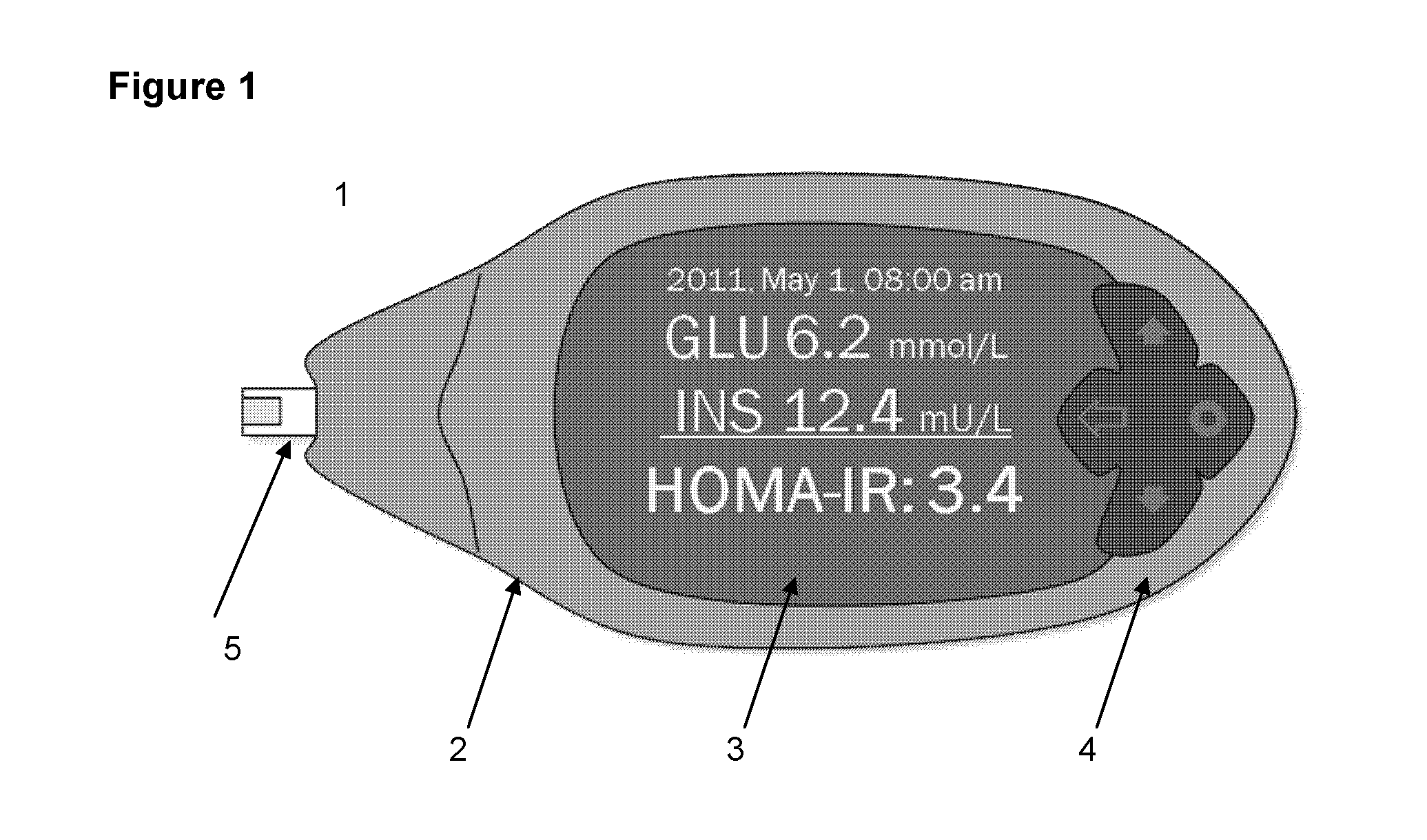 Assay and method for determining insulin-resistance