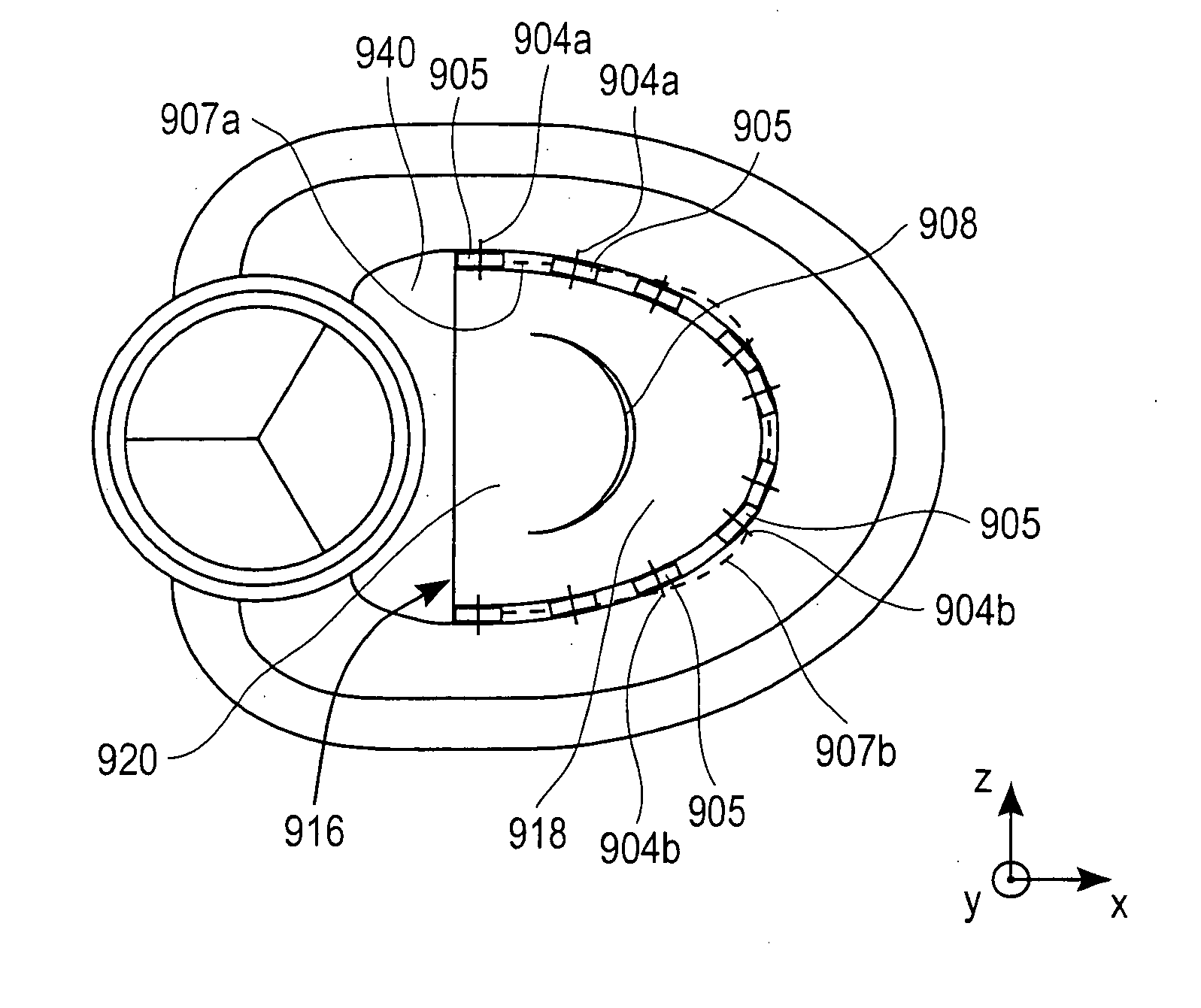 Method and apparatus for performing catheter-based annuloplasty using local plications