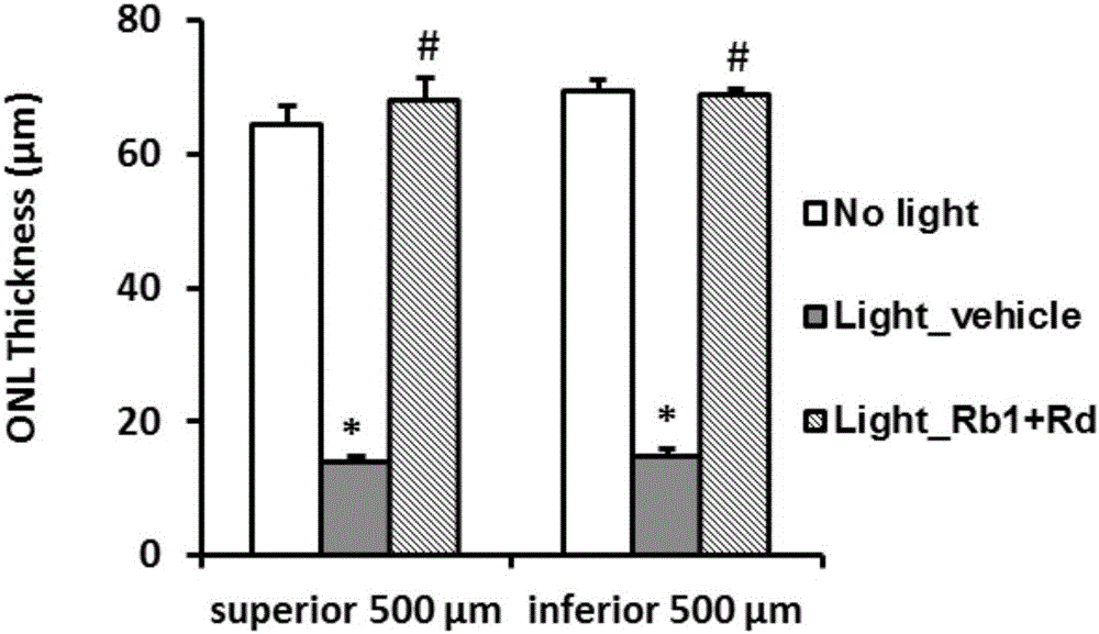 Ginsenoside Rb1 and Rd combination and application thereof to preparation of medicine for treating photoreceptor cell death related diseases