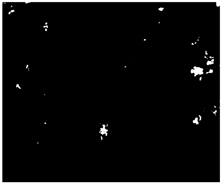 Acquisition method for exosomes derived from human urinary cells and application