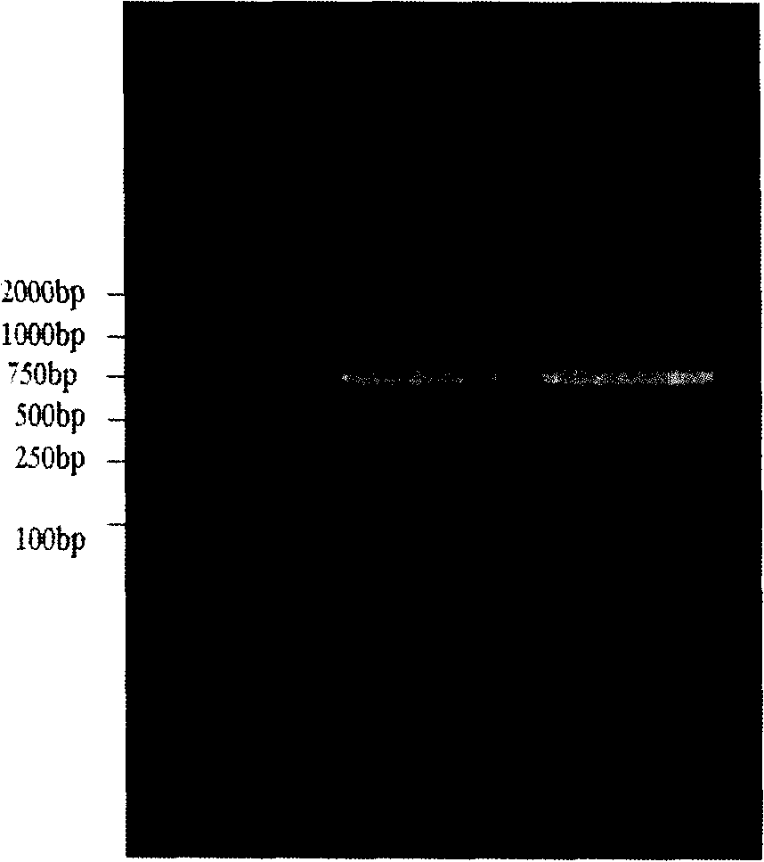 Bacillus anthracis gamma bacterial virus catenase expression method