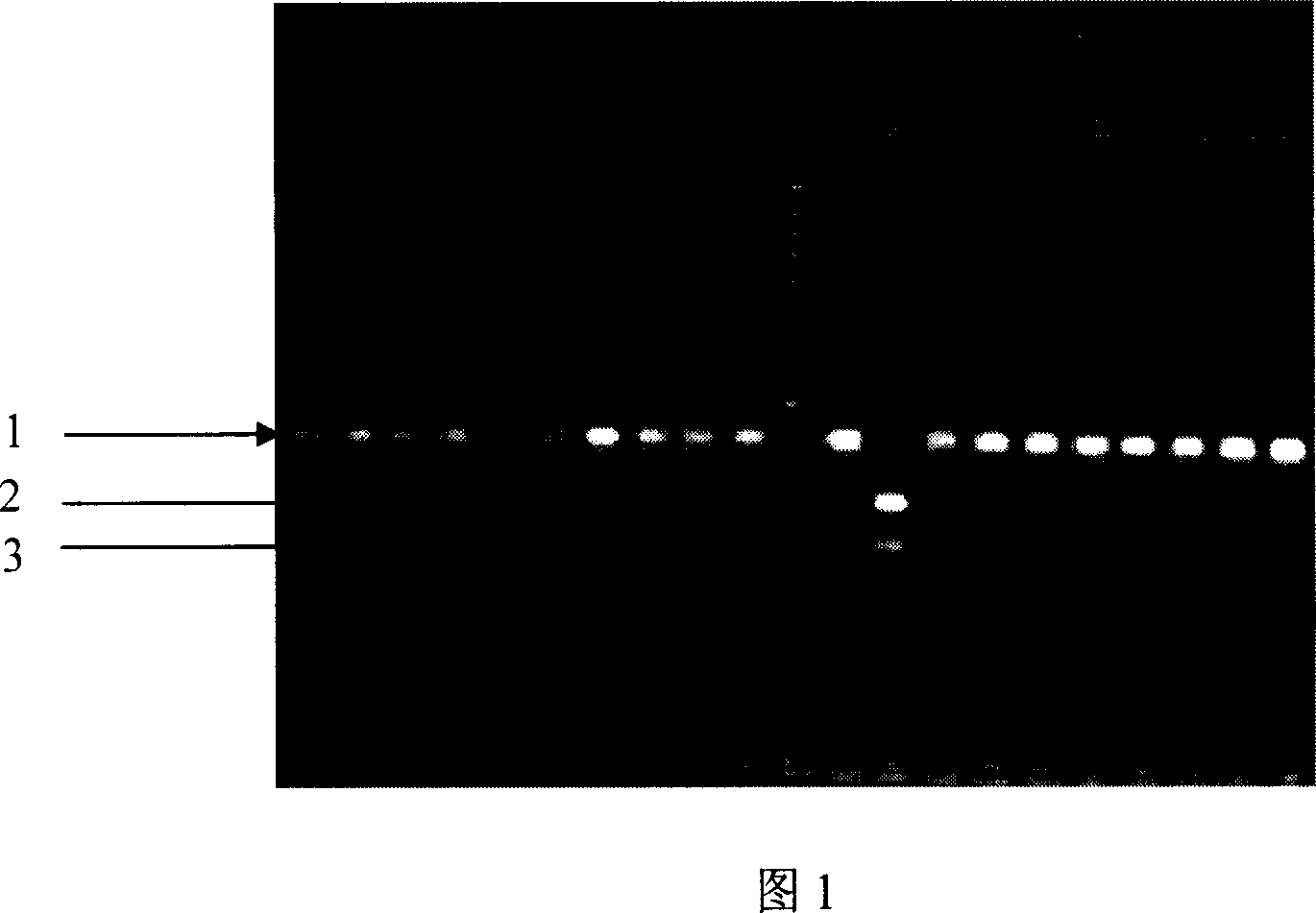 Reagent case for predicting action effect of angiotensin conversion enzyme inhibitor medicament