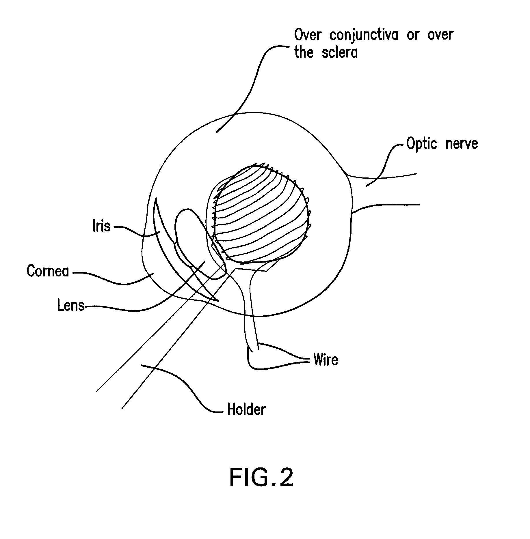 Method and composition for hyperthermally treating cells