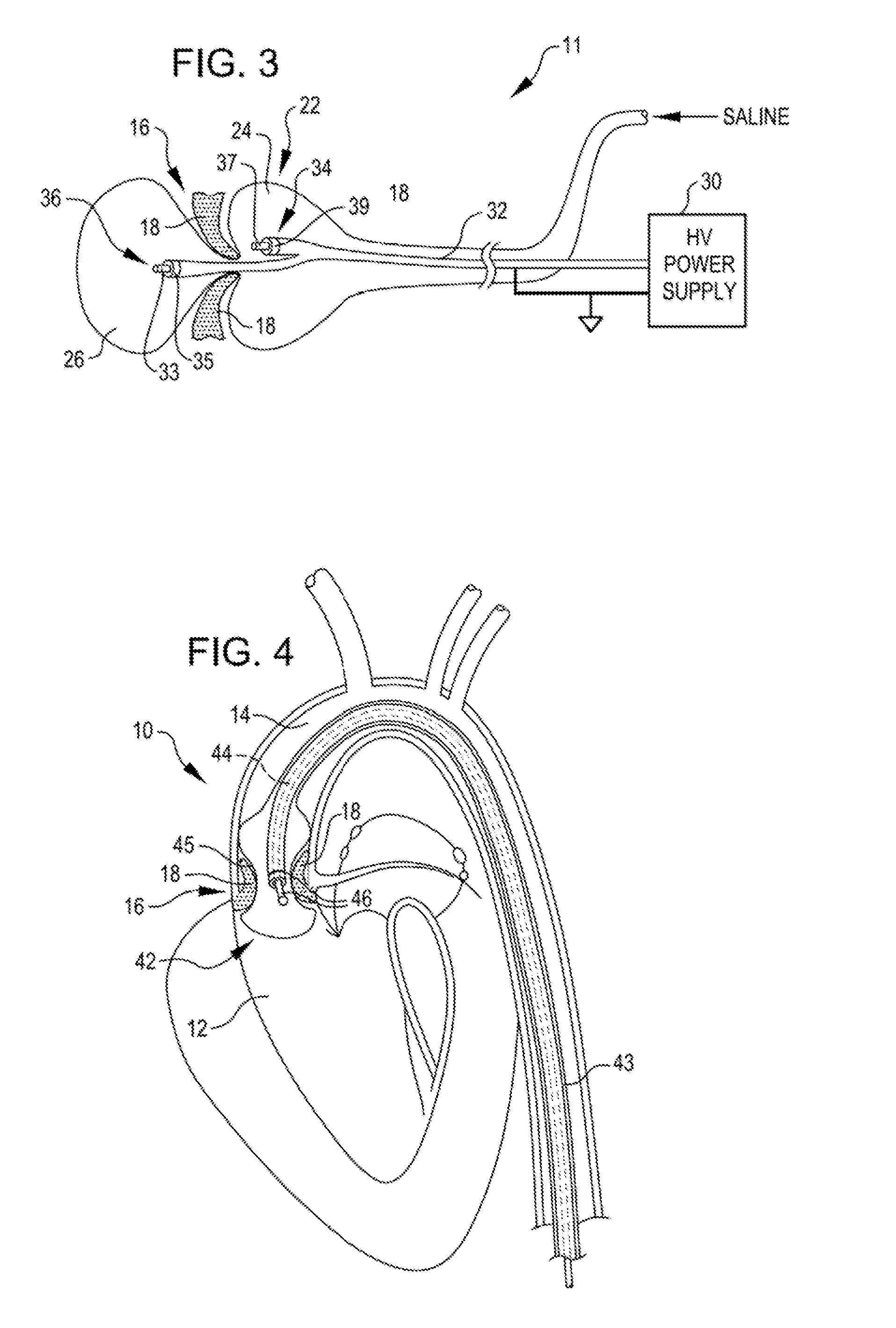 Shockwave valvuloplasty catheter system