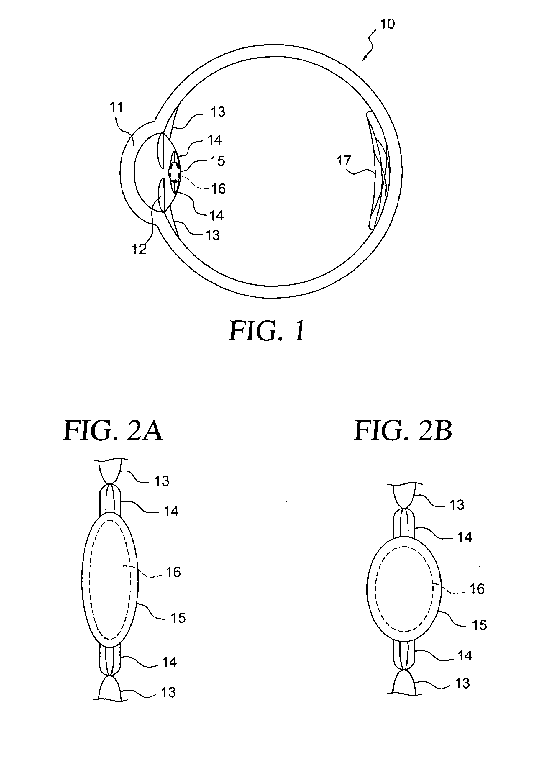 Accommodating intraocular lens having peripherally actuated deflectable surface and method