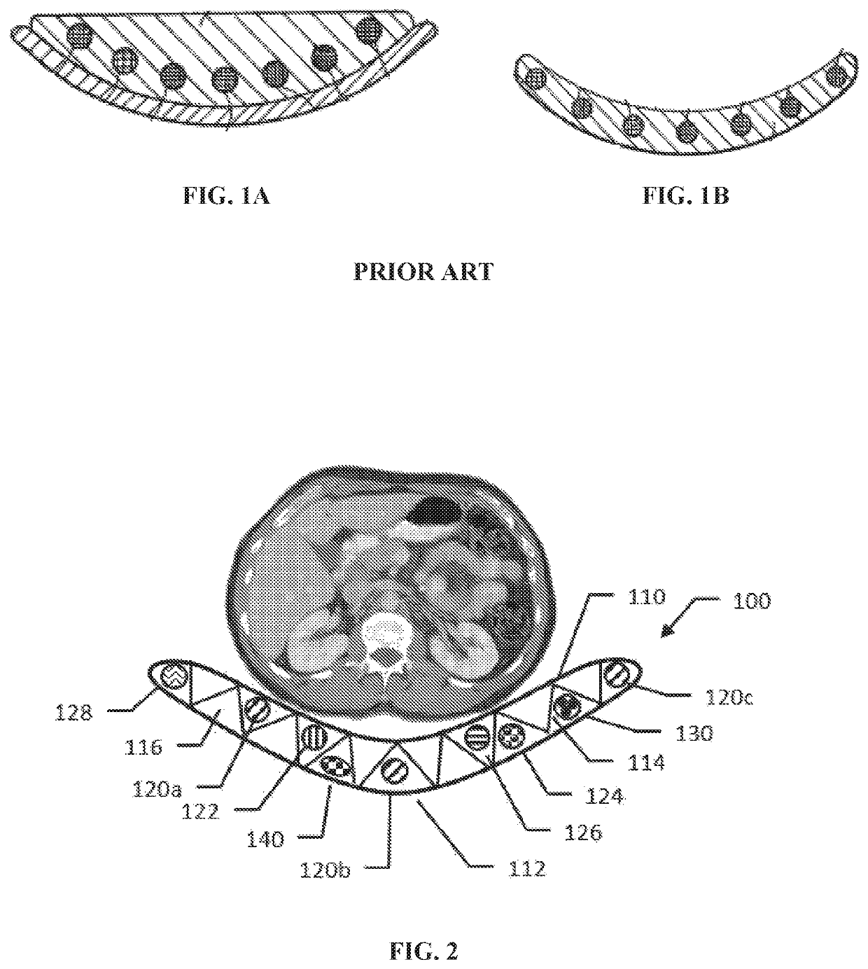 Quantification phantom for use with multiple imaging modalities