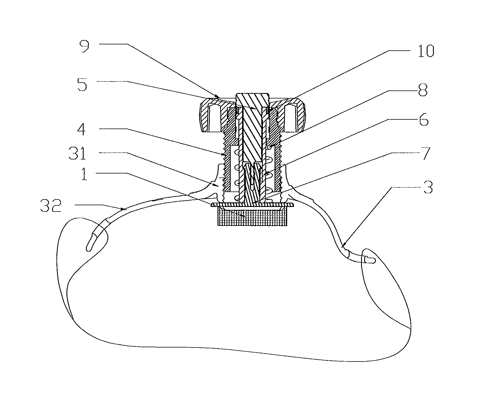 Compression hemostasis device