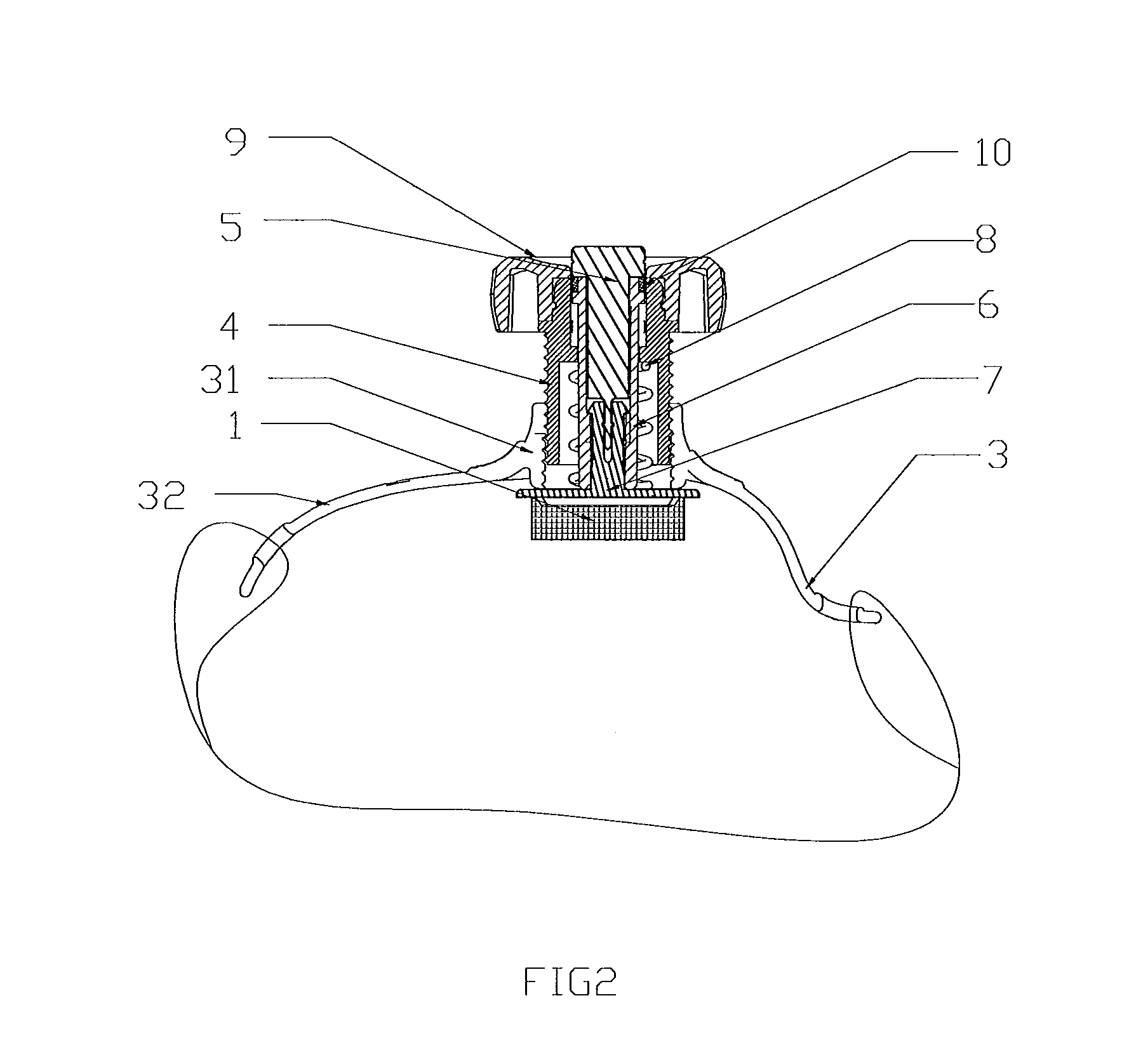 Compression hemostasis device