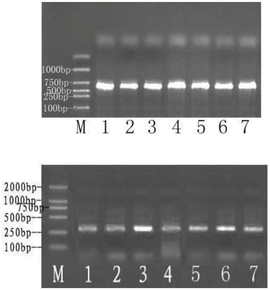 Traditional Chinese medicine composition for treating alzheimer disease, as well as preparation method and application thereof