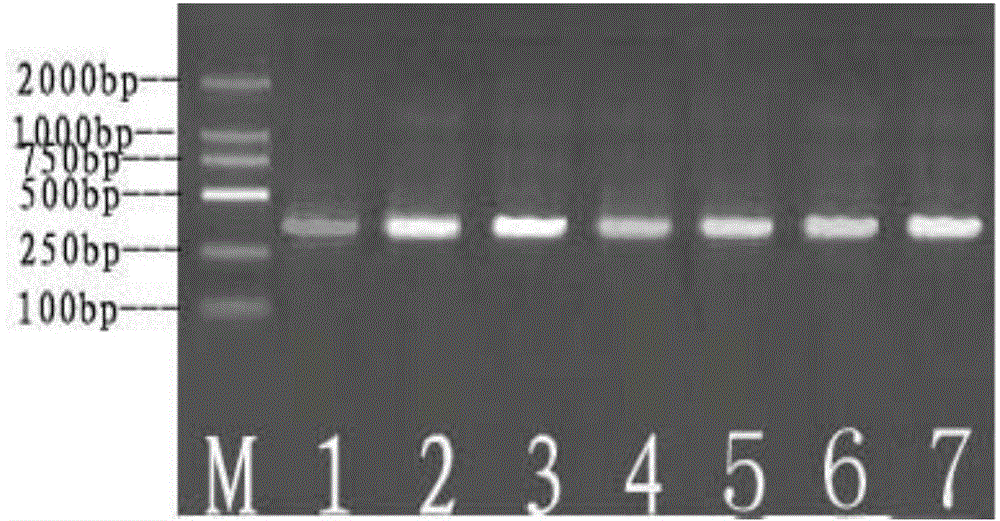 Traditional Chinese medicine composition for treating alzheimer disease, as well as preparation method and application thereof