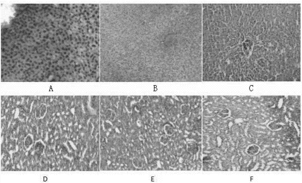 Veterinary-use radix daphniphylli calycini and red-knees herb granule and application thereof to chicken necrotic enteritis