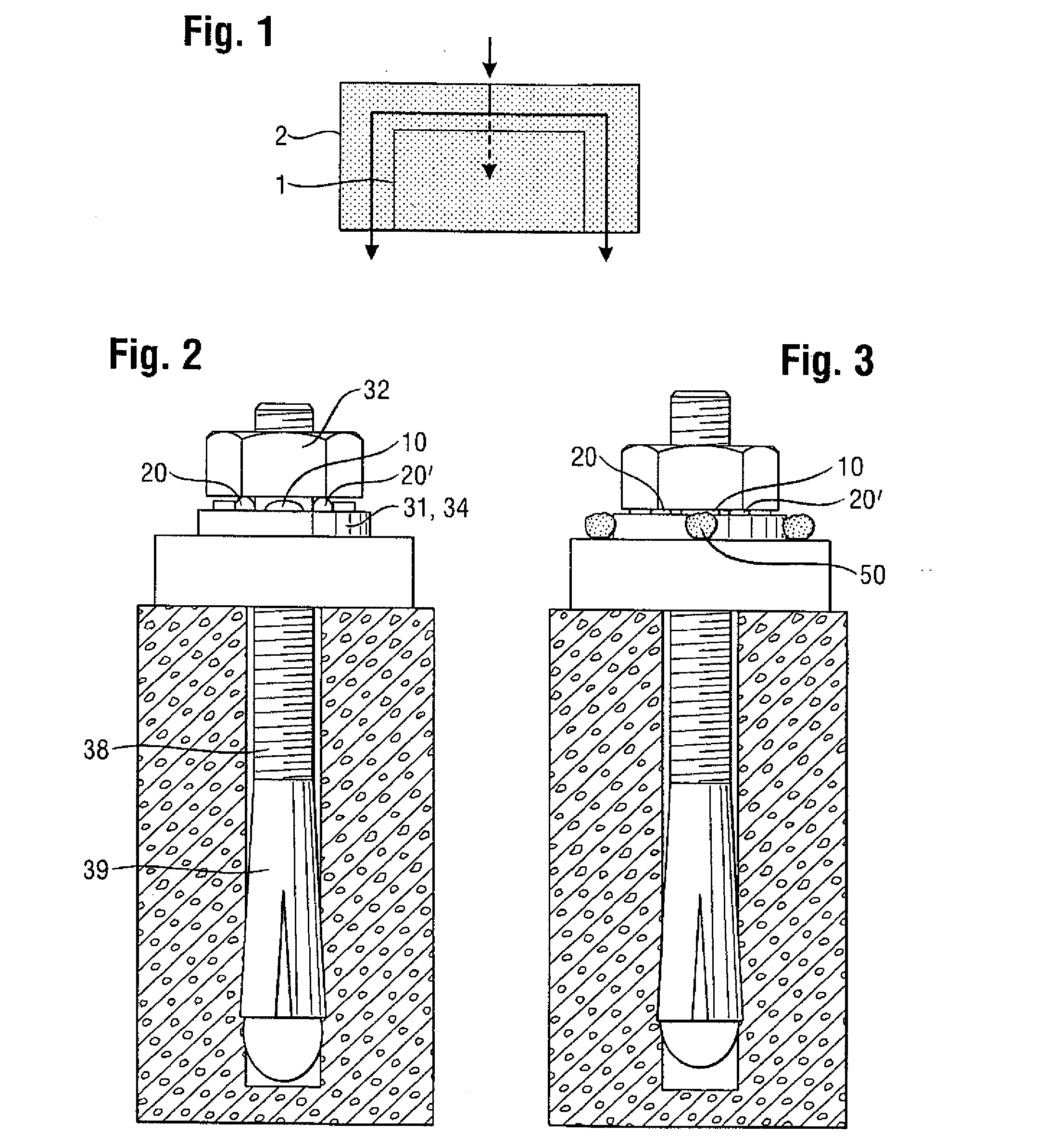 Sensor arrangement, for example, on an anchor bolt