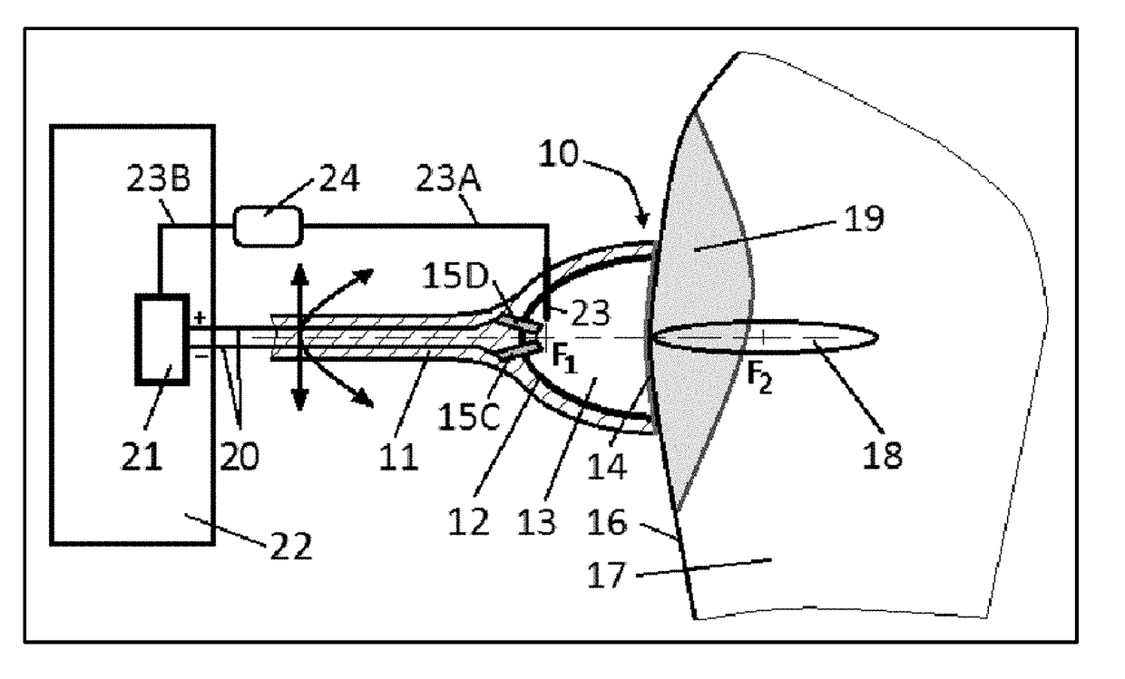 Acoustic pressure shock waves used for personalized medical treatment of tissue conditions