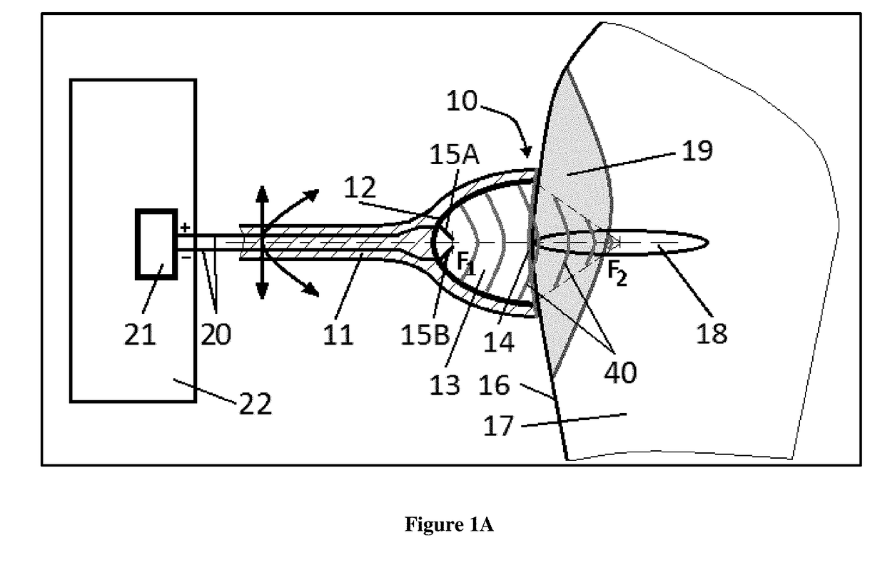 Acoustic pressure shock waves used for personalized medical treatment of tissue conditions