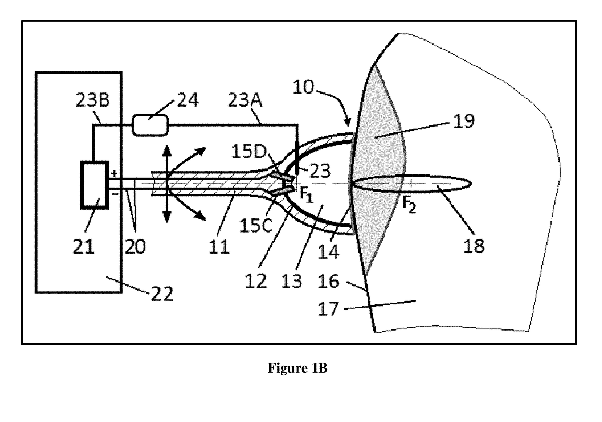 Acoustic pressure shock waves used for personalized medical treatment of tissue conditions