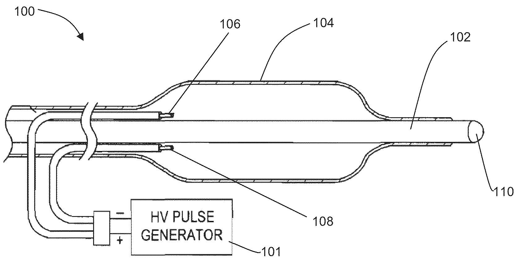 Shockwave nerve therapy system and method