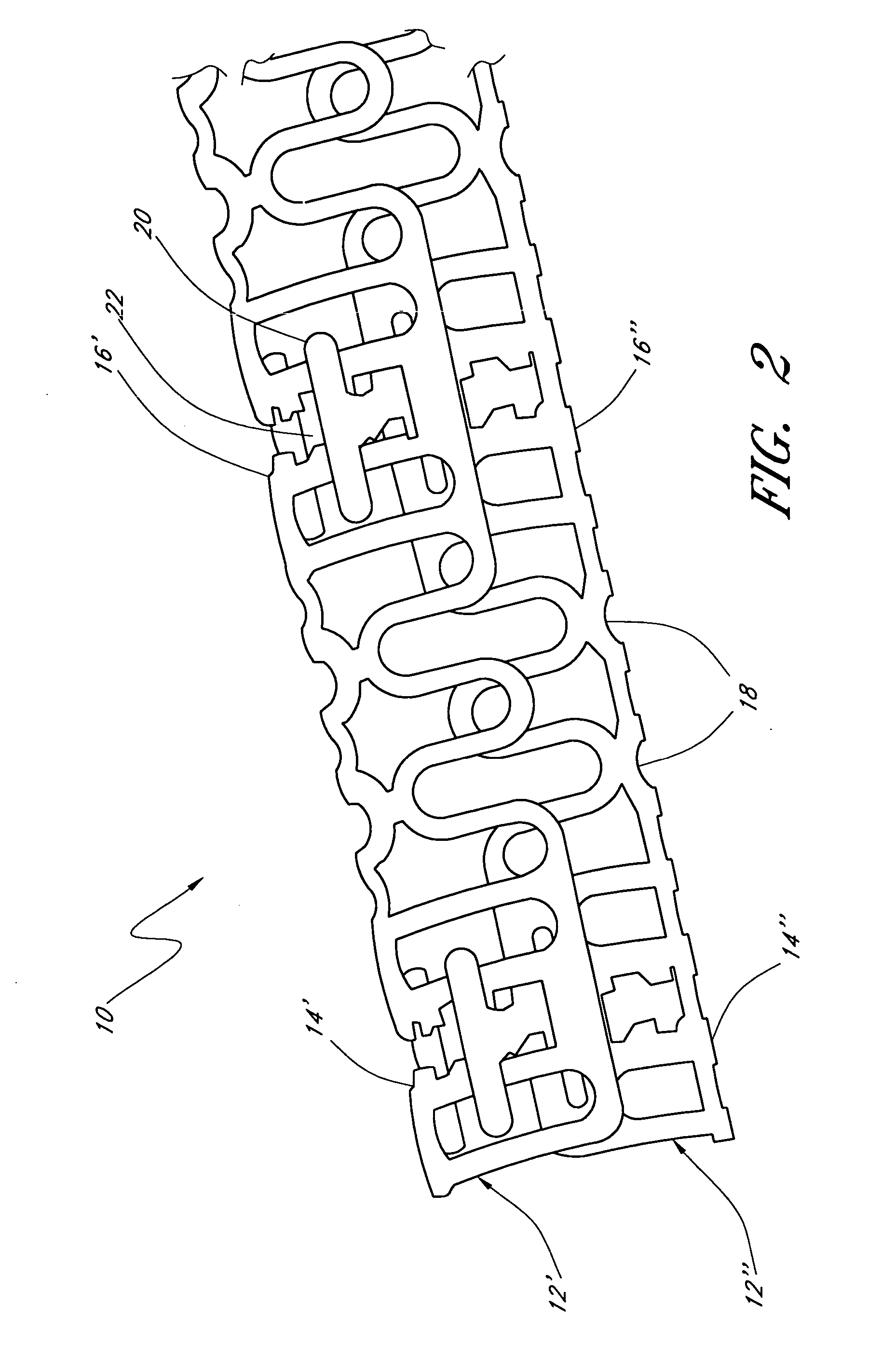 Slide-and-lock stent