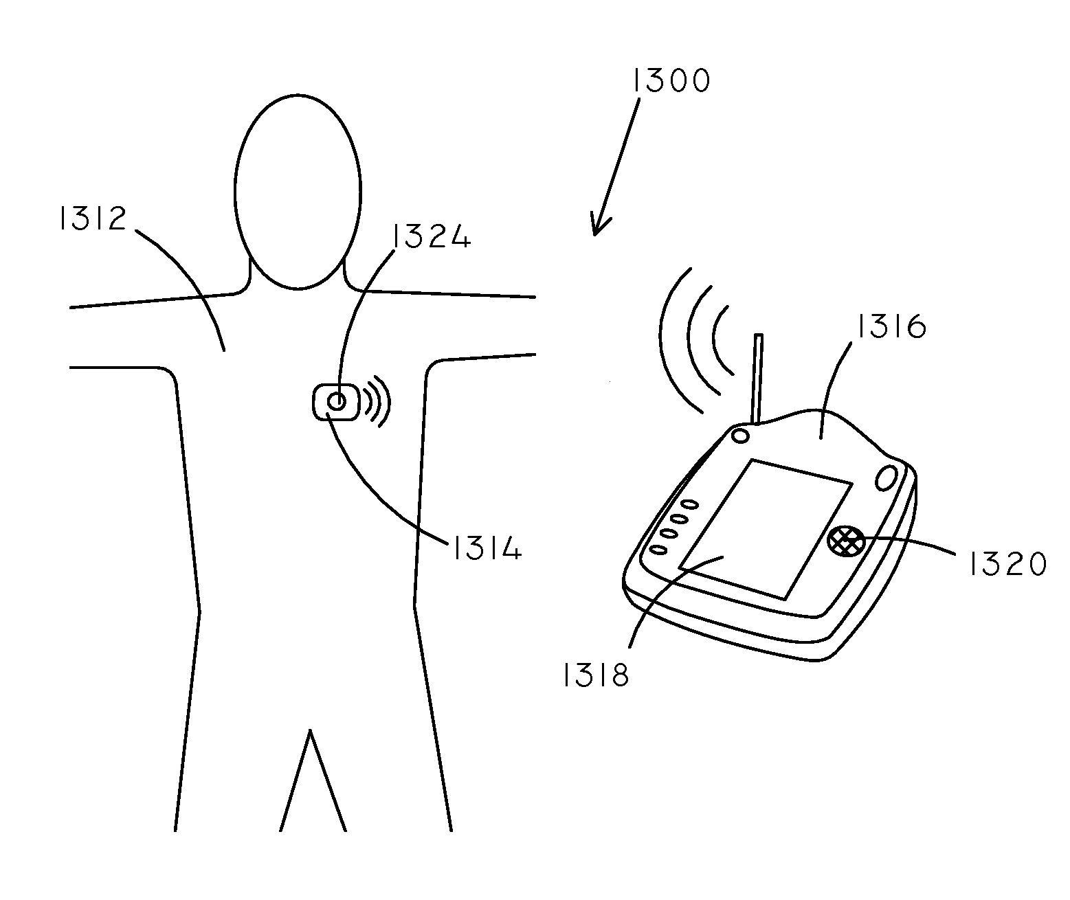 Implantable Creatinine Sensor and Related Methods