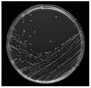 Degradation strain of sterilization agent kresoxim-methyl and application thereof