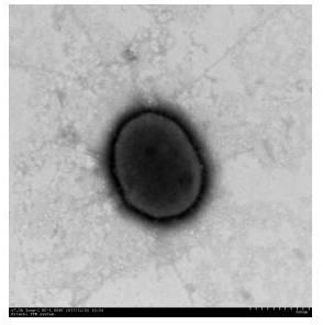 Degradation strain of sterilization agent kresoxim-methyl and application thereof