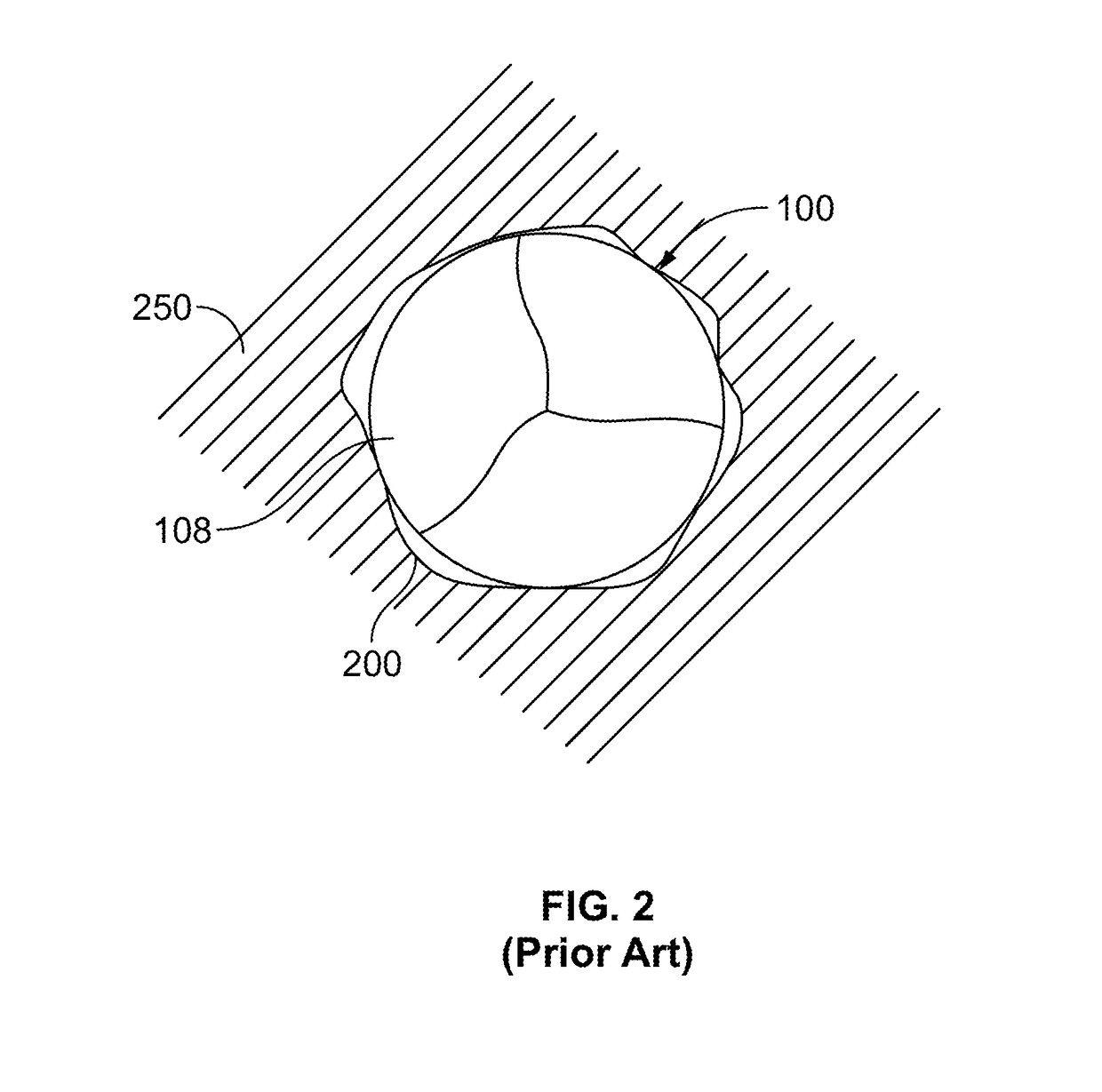 Transcatheter valve with paravalvular leak sealing ring