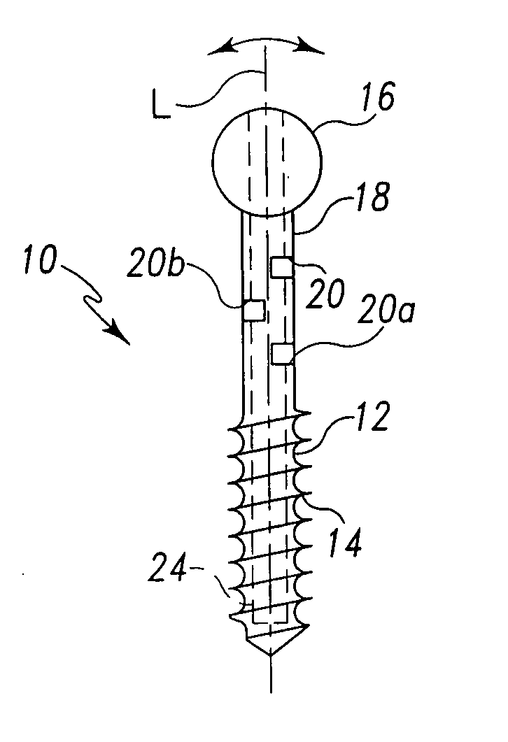 Dynamic spinal stabilization system