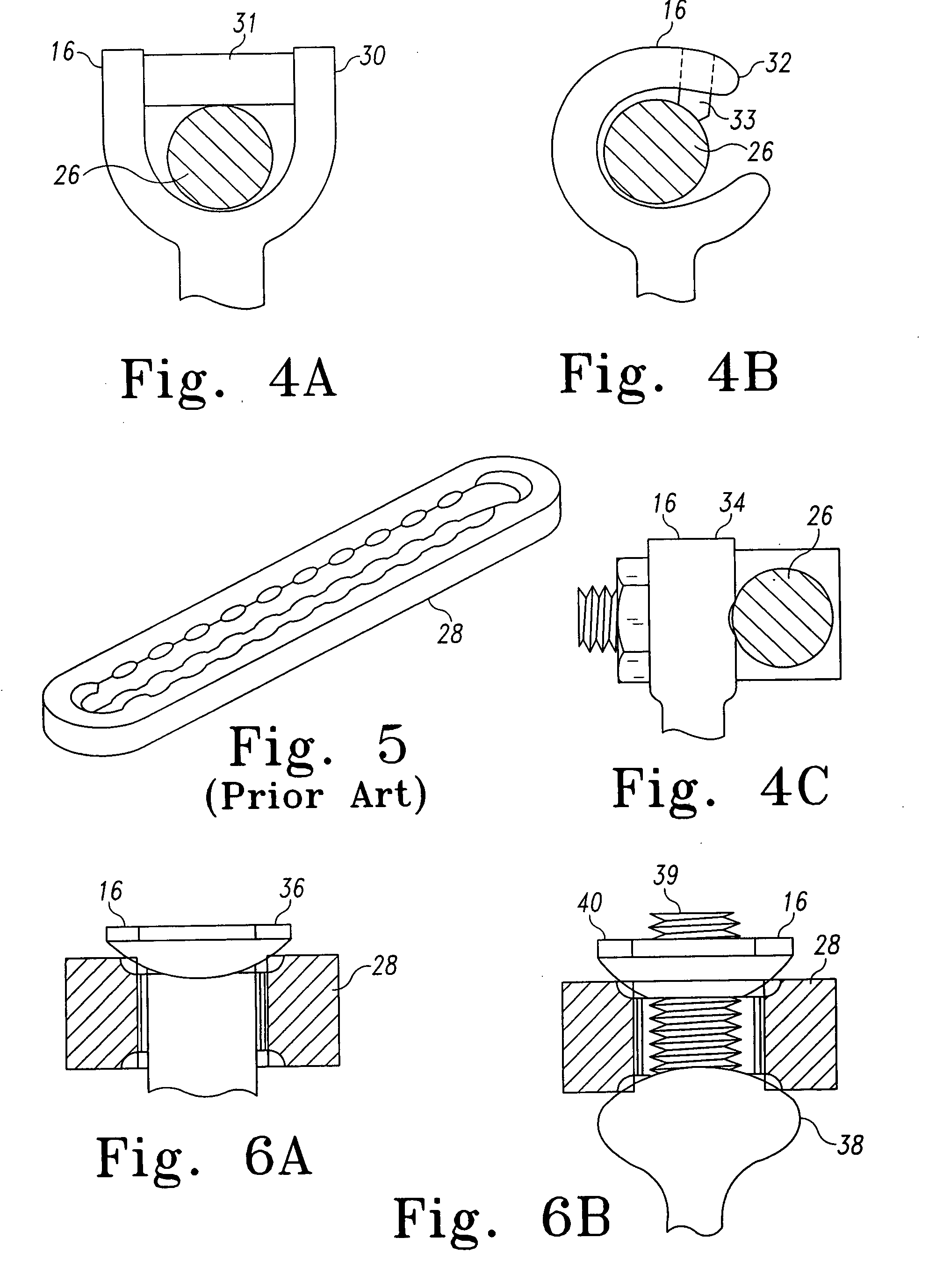 Dynamic spinal stabilization system