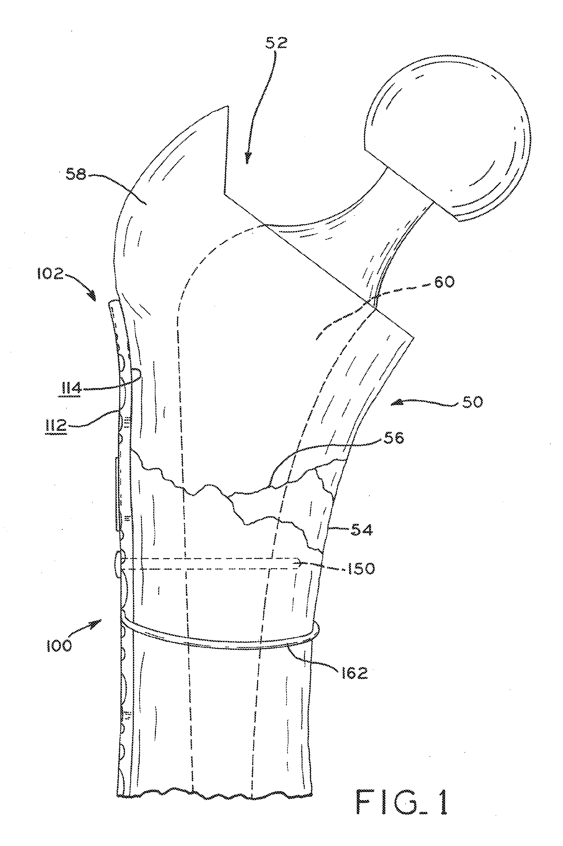 Periprosthetic bone plates